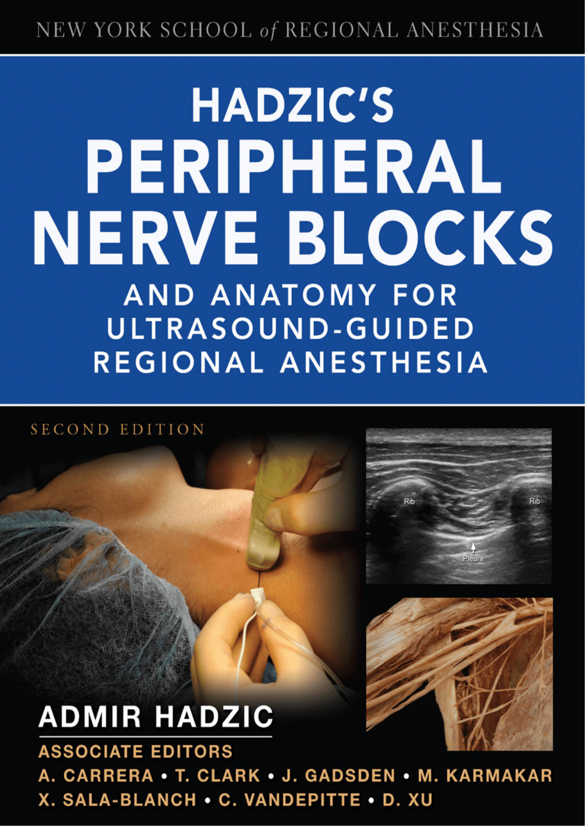 Hadzic's Peripheral Nerve Blocks 第三版 Hadzic's Peripheral Nerve Blocks and by: Admir Hadzic