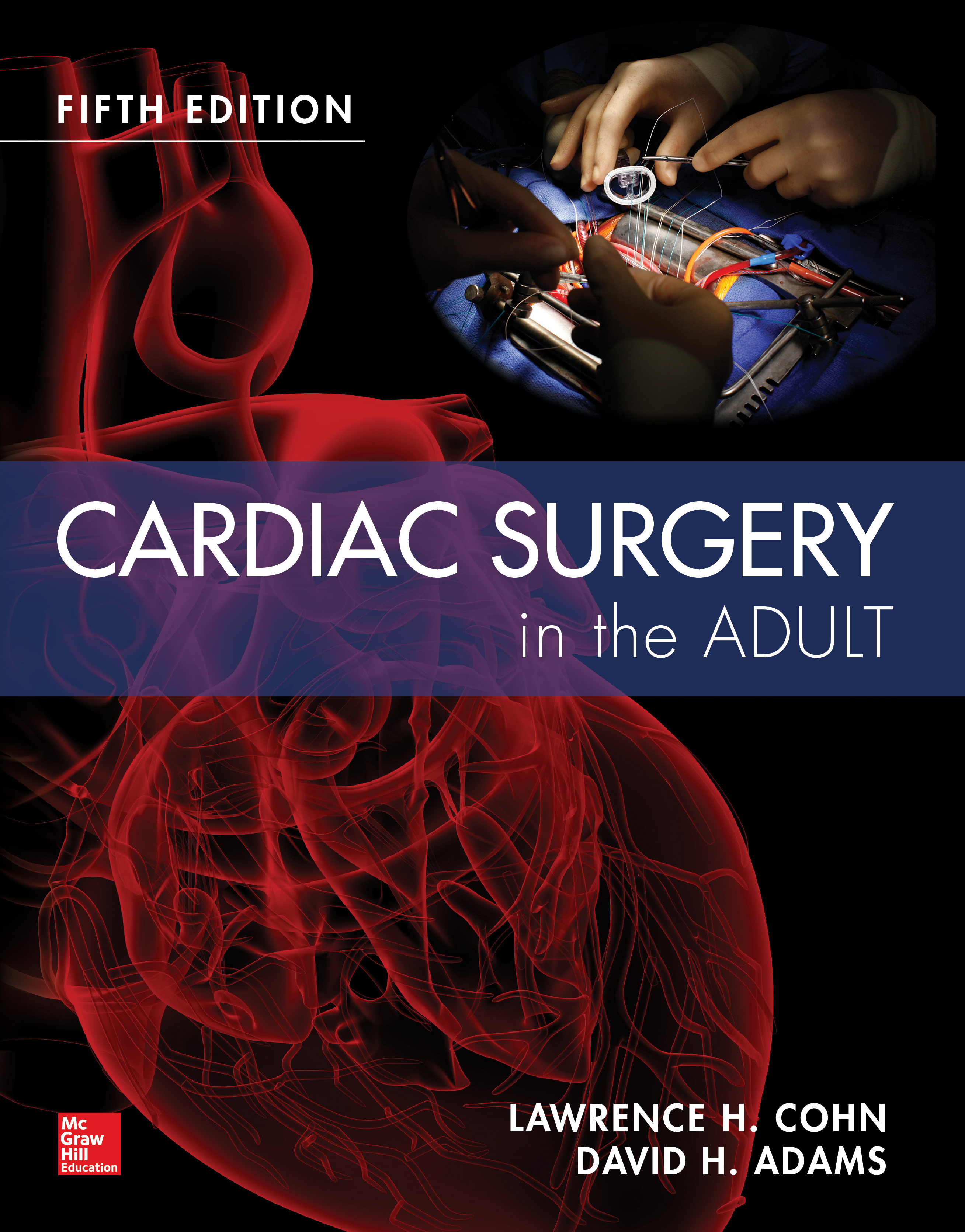 Cardiac Surgery in the Adult Fifth Edition