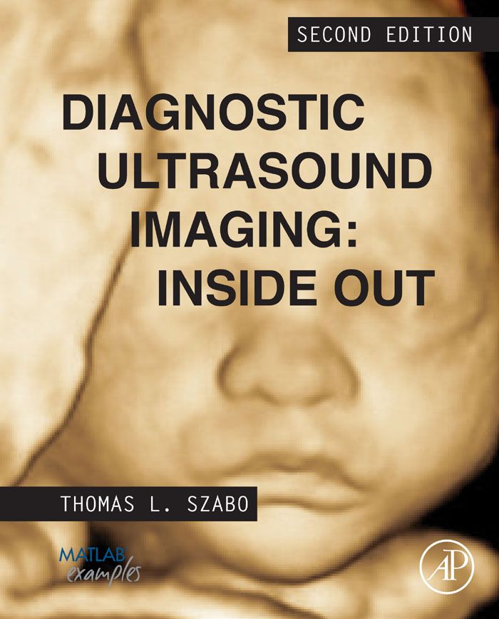 Cover image for Diagnostic Ultrasound Imaging: Inside Out