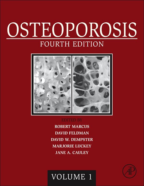 Cover image for Osteoporosis