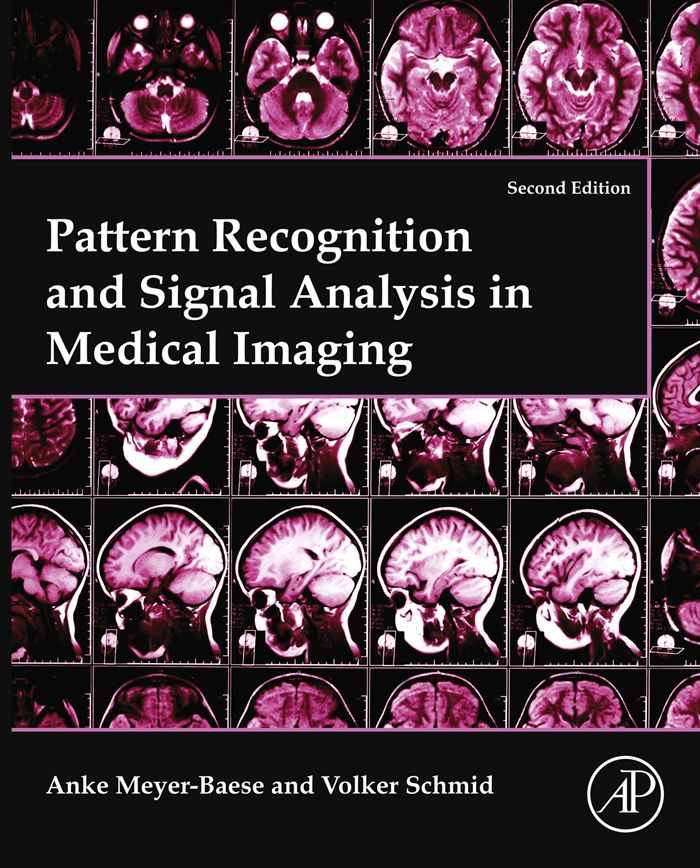 Cover image for Pattern Recognition and Signal Analysis in Medical Imaging