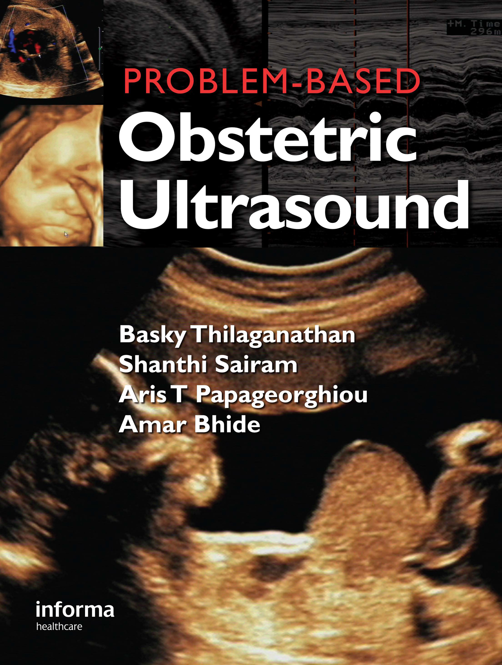Cover image for Problem Based Obstetric Ultrasound