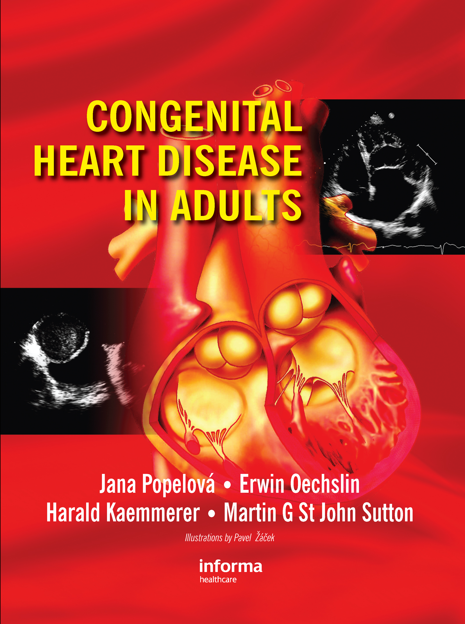 Cover image for Congenital Heart Disease in Adults