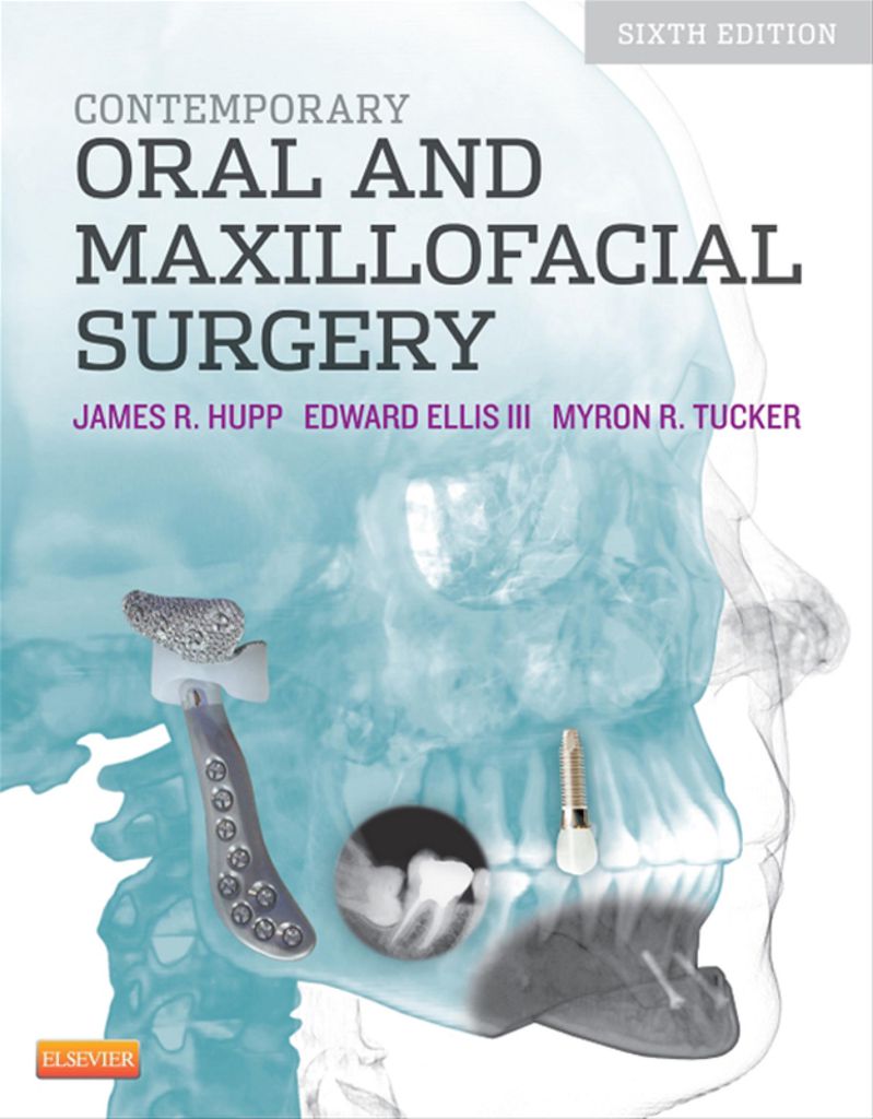 現代口腔外科学 James R.Hupp Contemporary Oral and Maxillofacial by: James R. Hupp