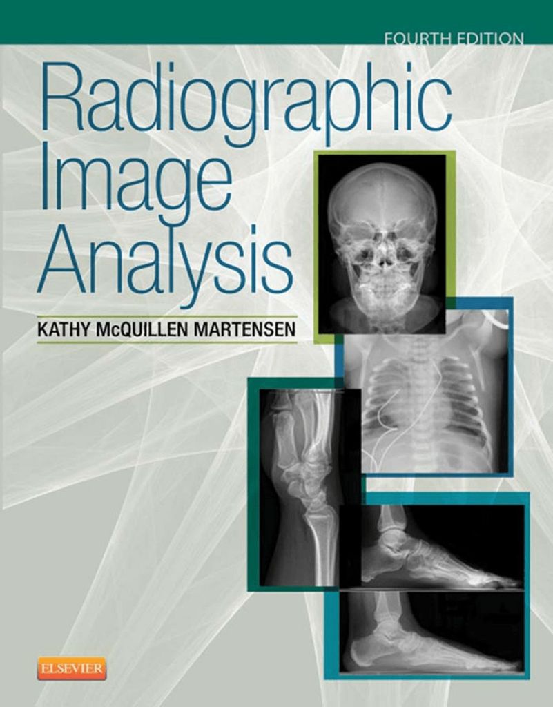 Radiographic Image Analysis - E-Book by: Kathy McQuillen-Martensen