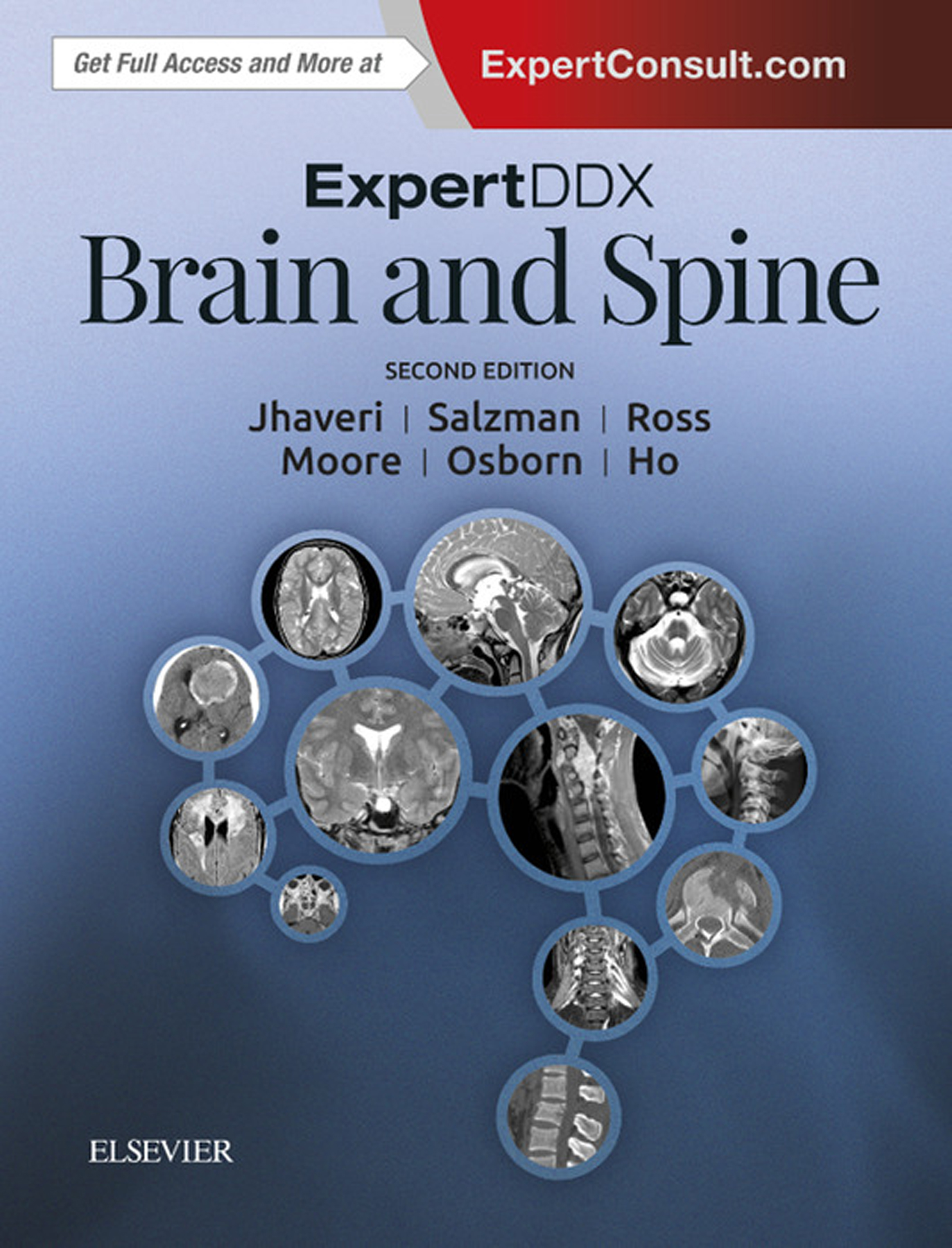 Cover image for ExpertDDx: Brain and Spine E-Book