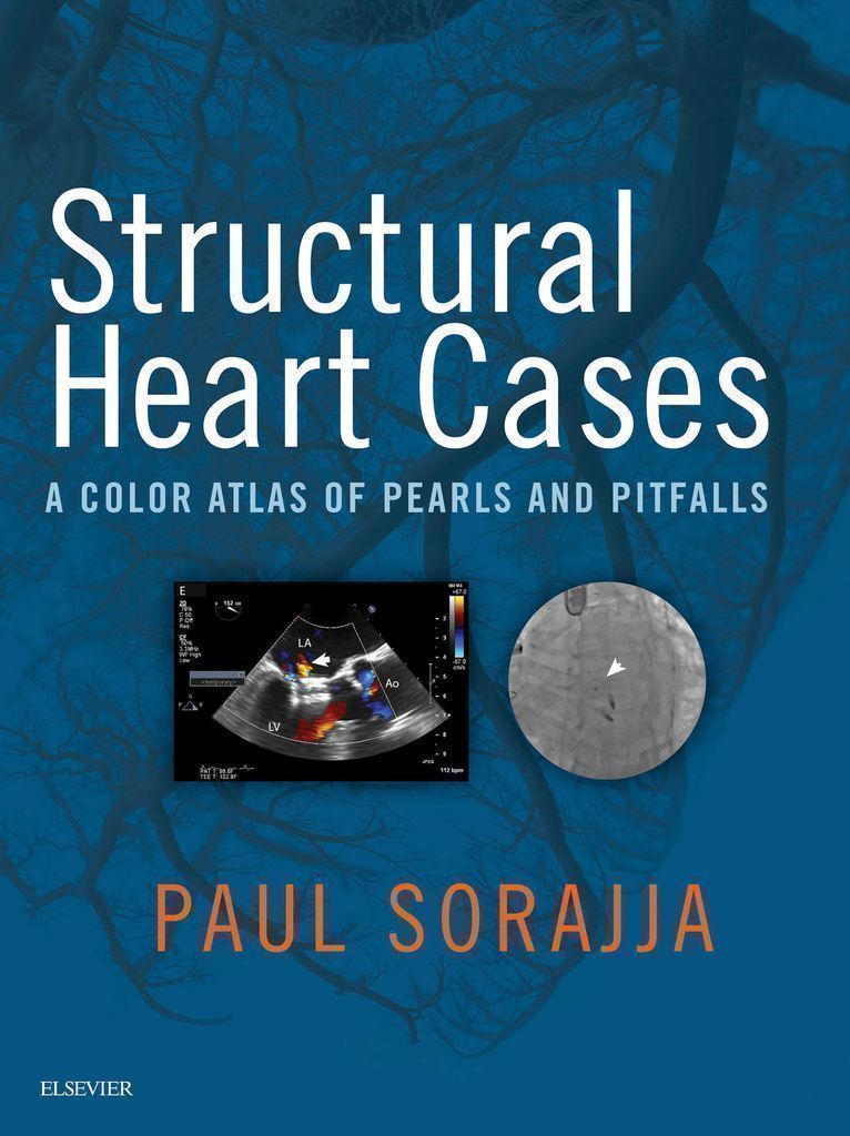 Cover image for Structural Heart Cases E-Book