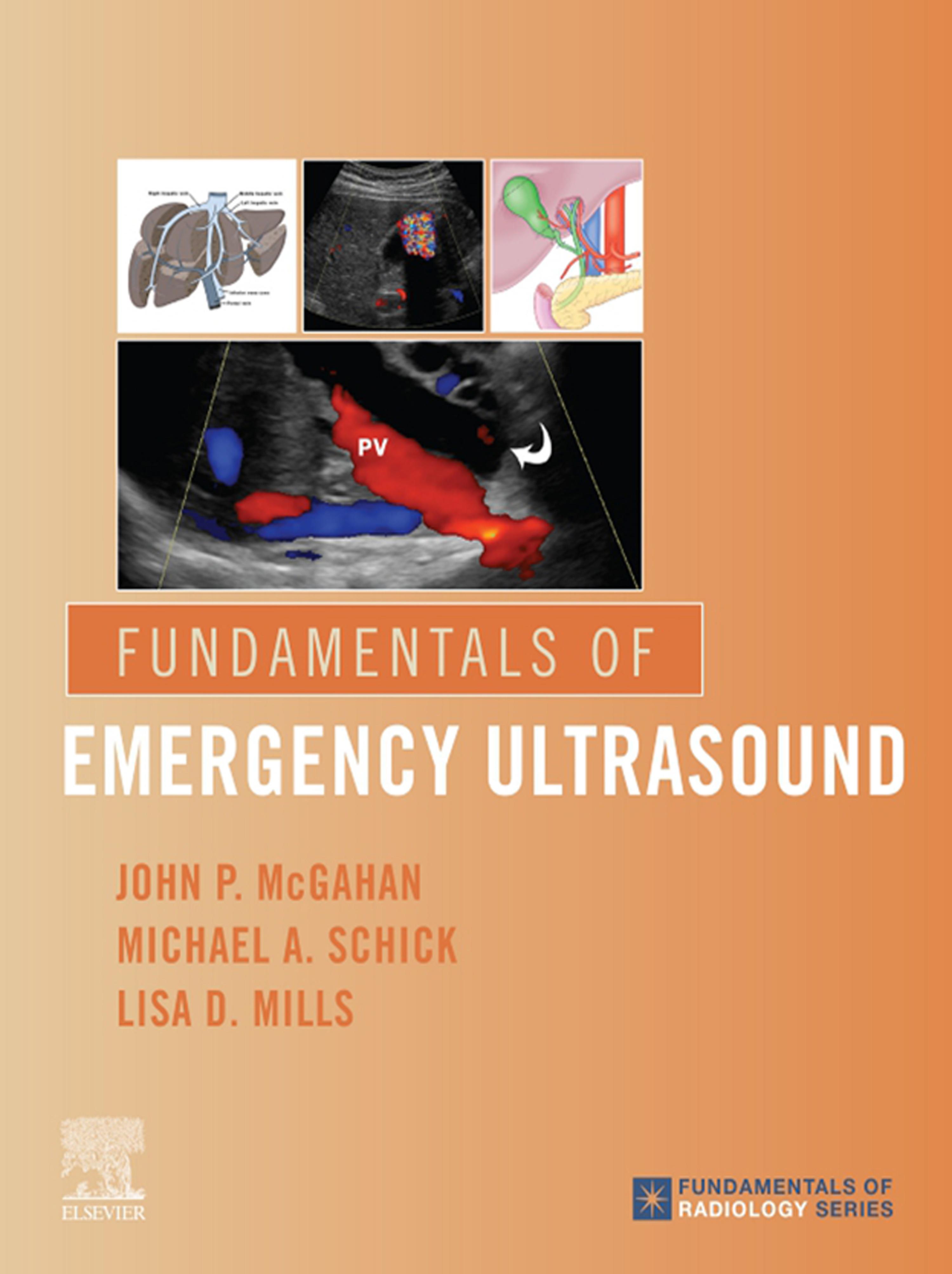 Cover image for Fundamentals of Emergency Ultrasound