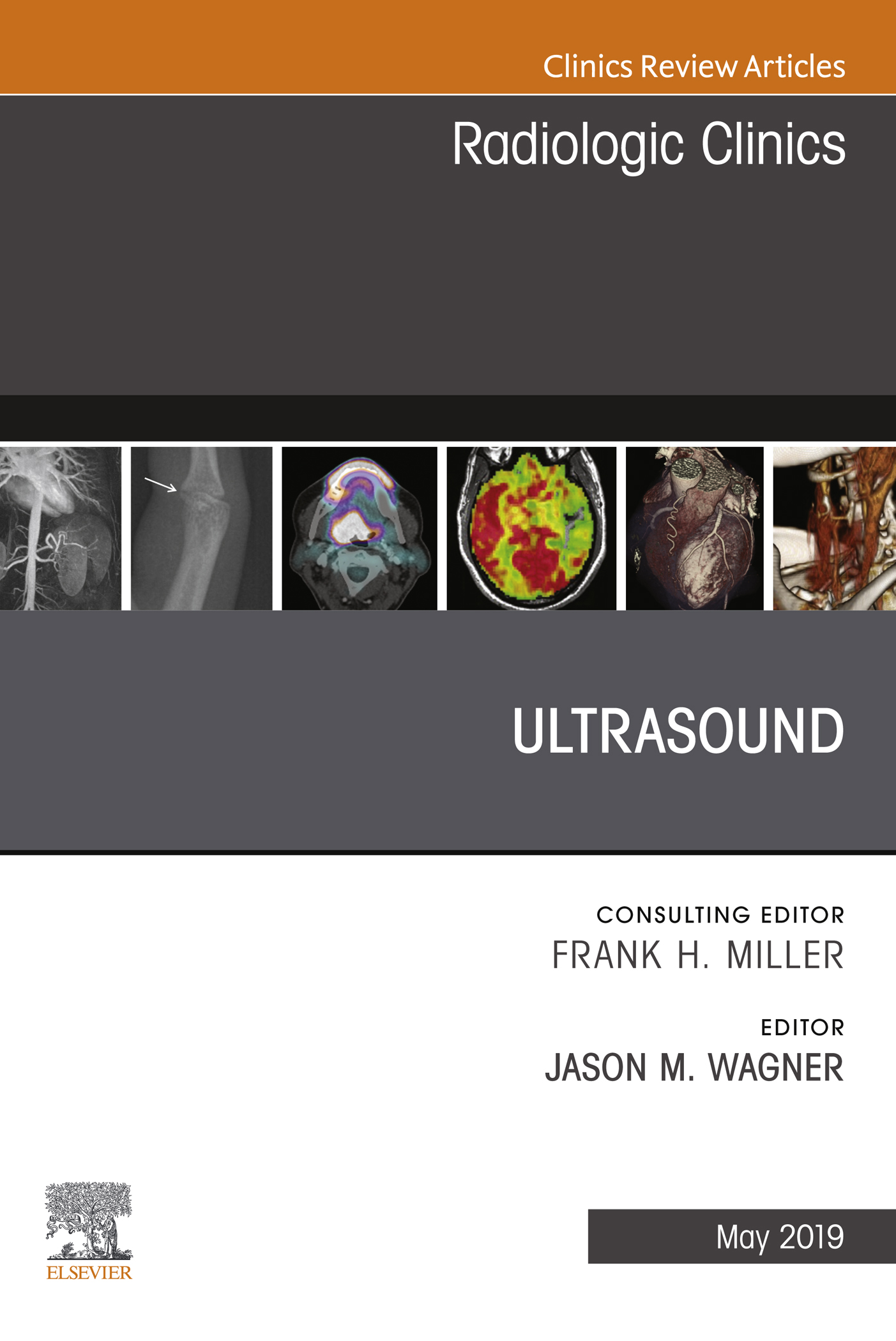 ISBN 9780323678322 product image for Ultrasound, An Issue of Radiologic Clinics of North America, Ebook | upcitemdb.com