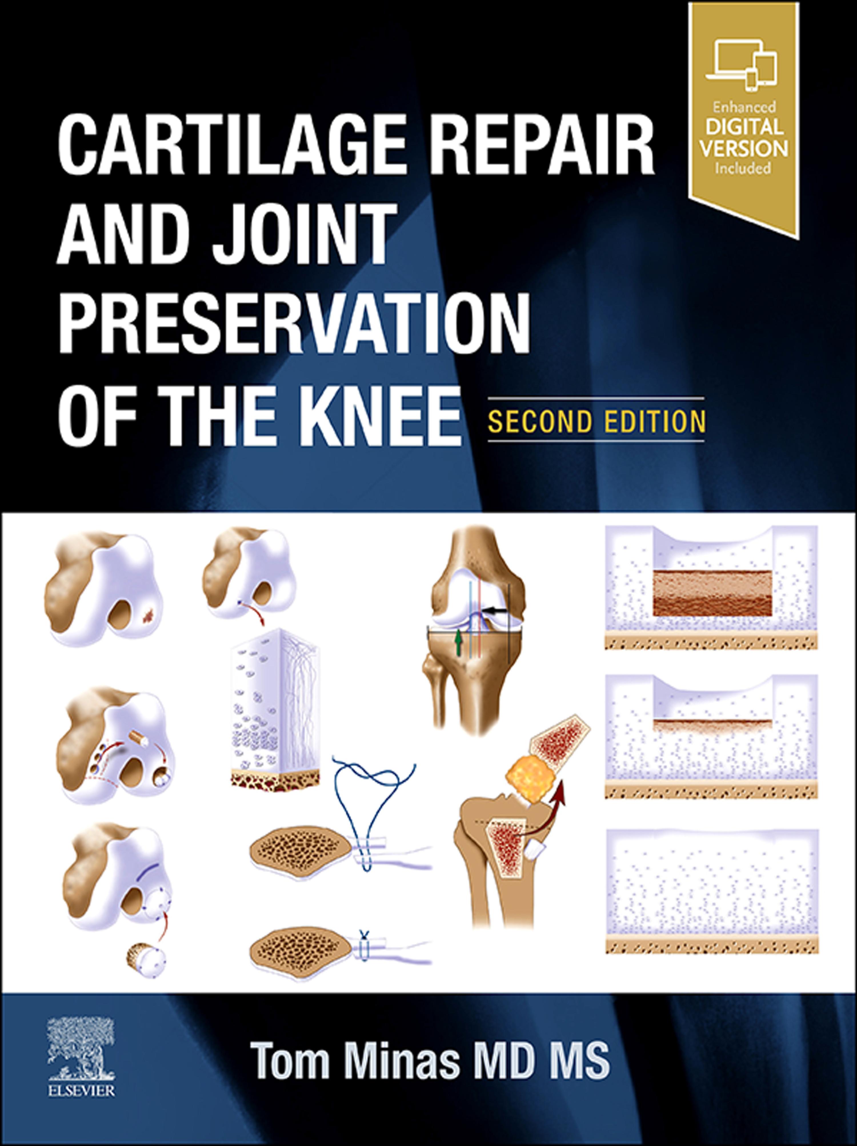 Cover image for Cartilage Repair and Joint Preservation of the Knee