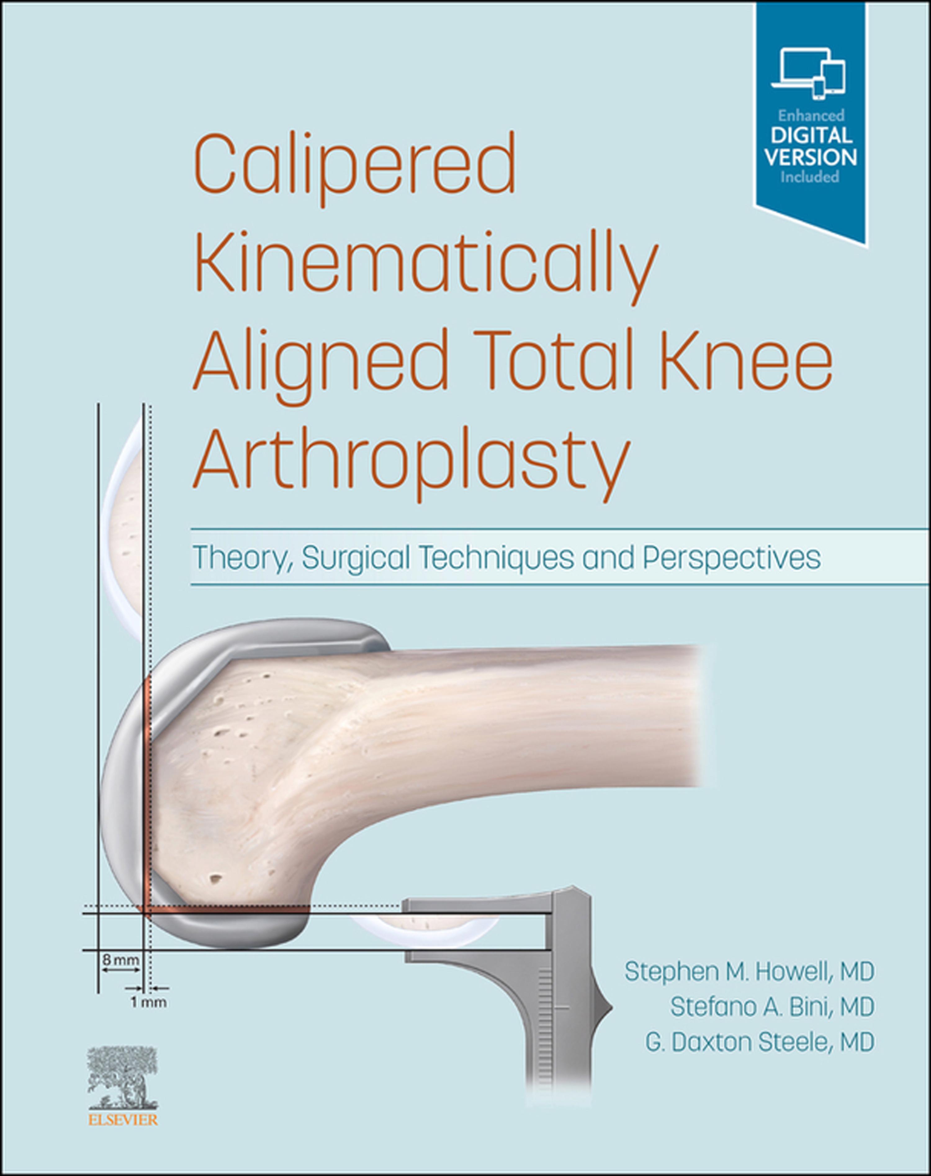Cover image for Calipered Kinematically aligned Total Knee Arthroplasty E-Book