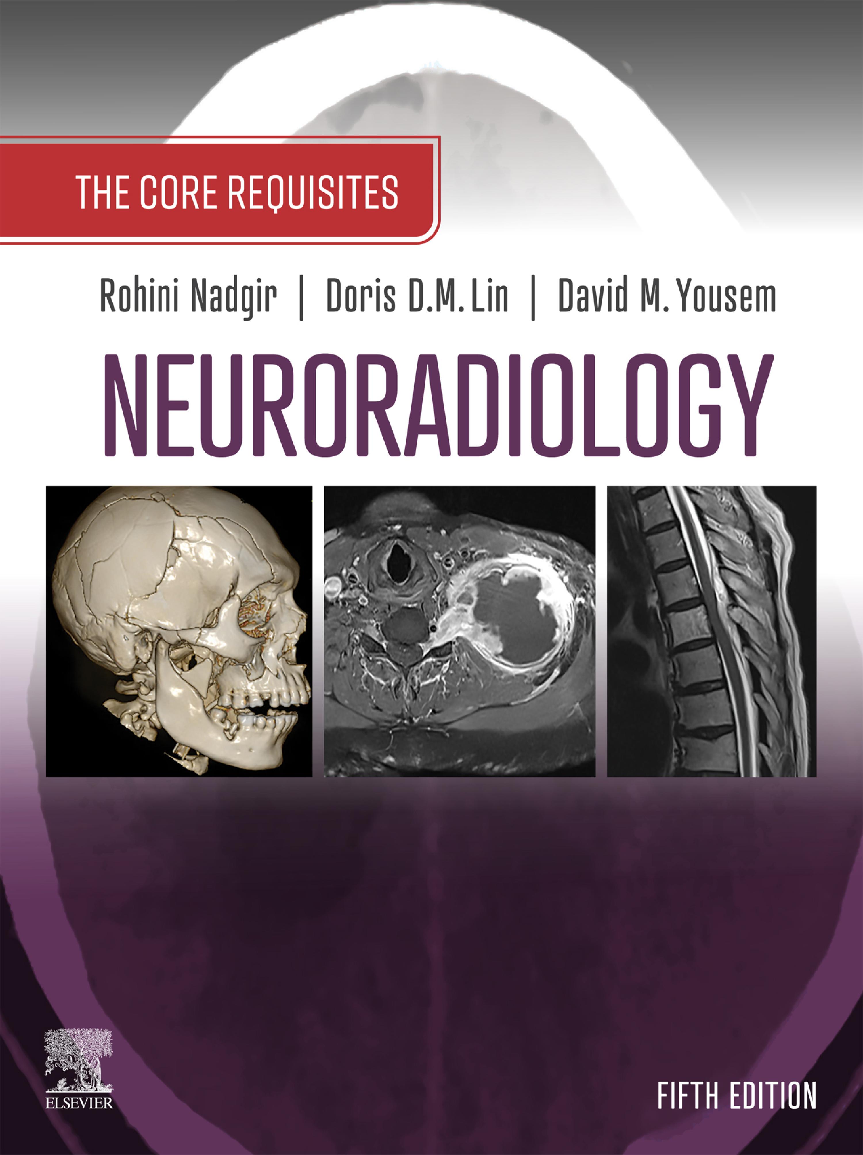 Cover image for Neuroradiology: The Requisites E-Book