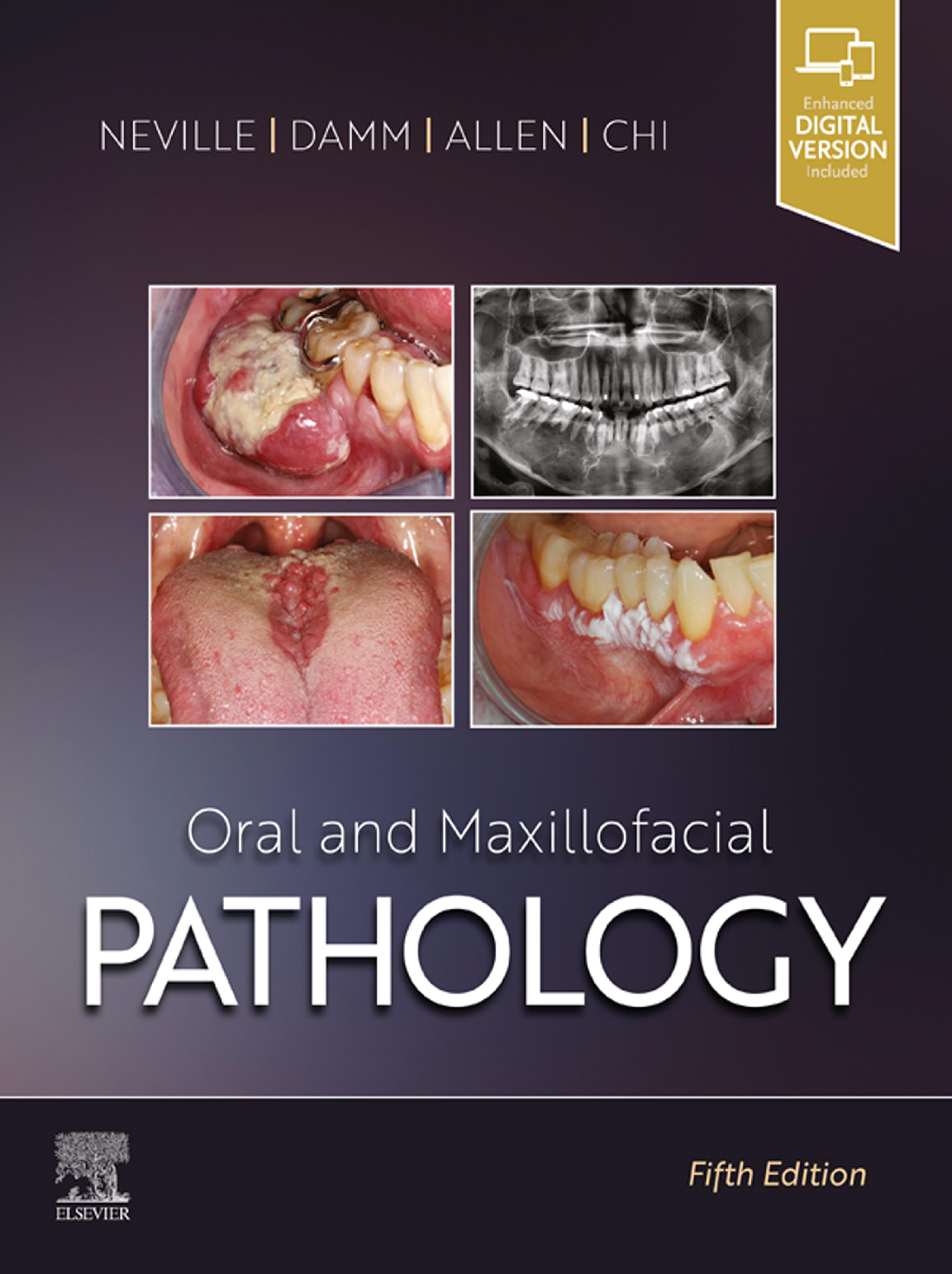 Cover image for Oral and Maxillofacial Pathology - E-Book