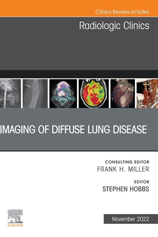 Cover image for Imaging of Diffuse Lung Disease, An Issue of Radiologic Clinics of North America, E-Book