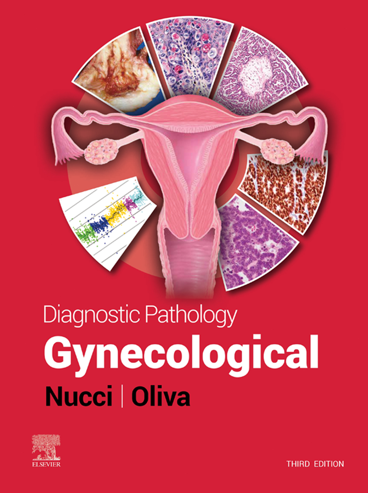 Cover image for Diagnostic Pathology: Gynecological E-Book