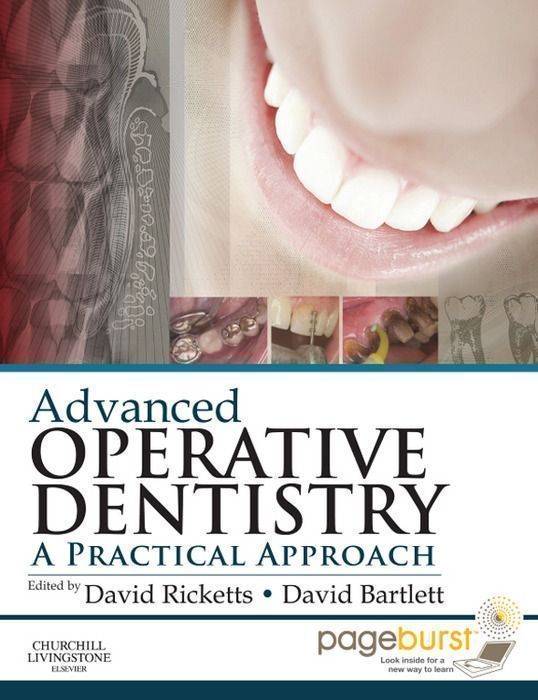 Cover image for Advanced Operative Dentistry