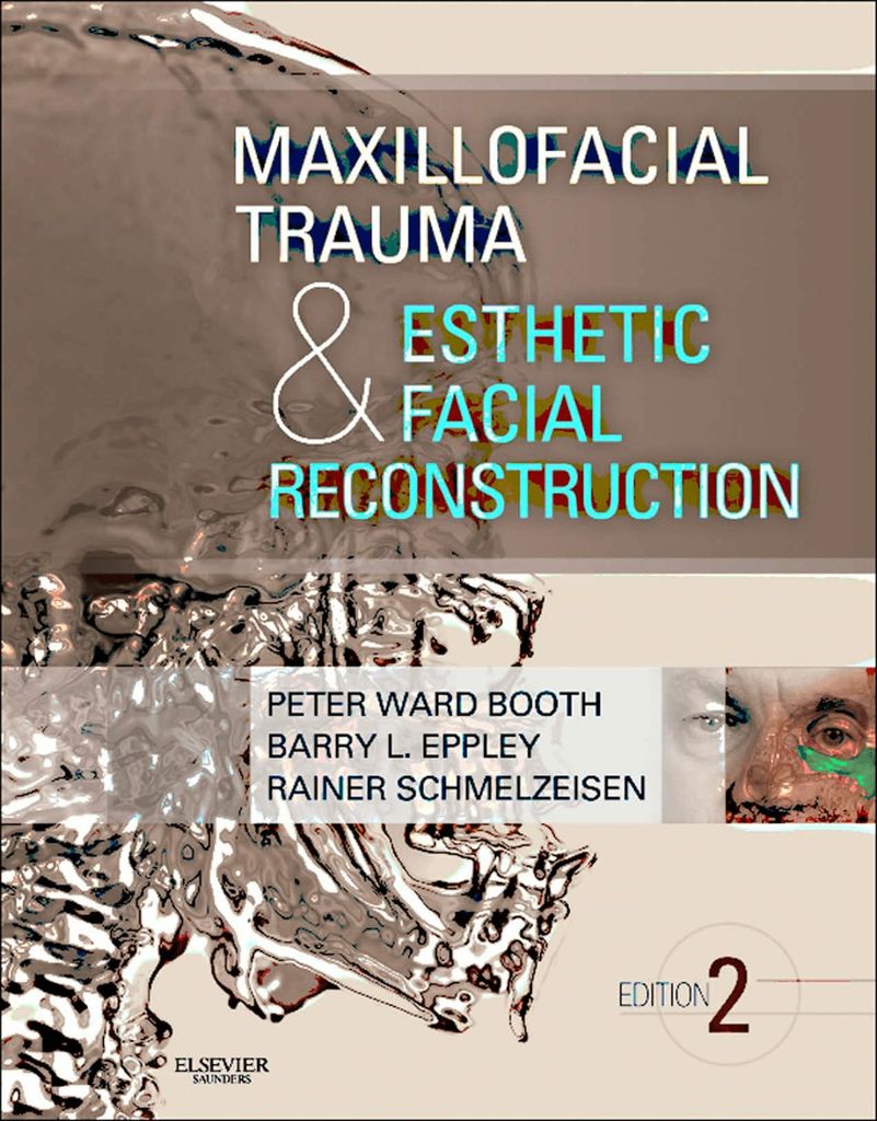 Maxillofacial Trauma and Esthetic Facial by: Peter Ward