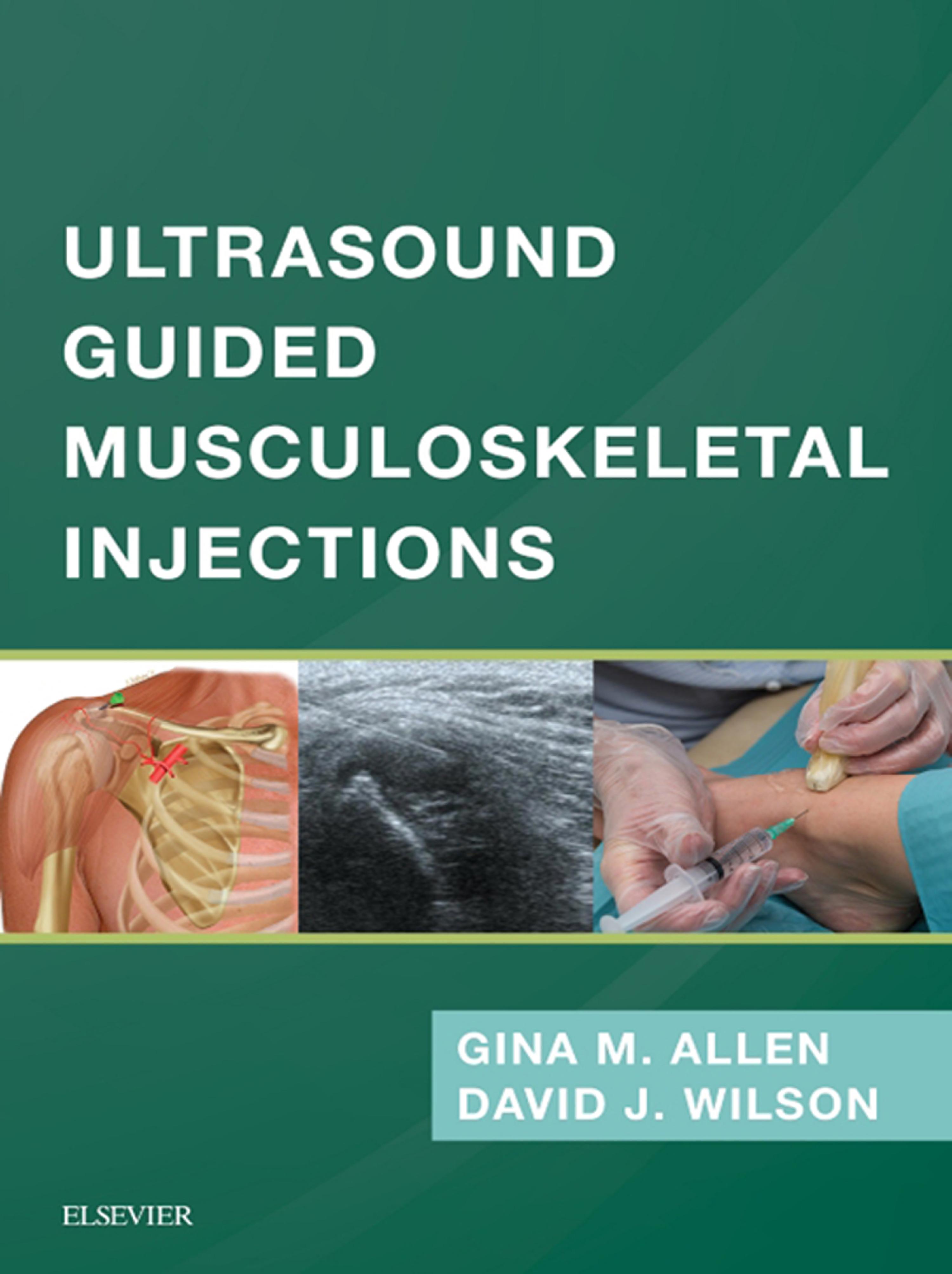 Cover image for Ultrasound Guided Musculoskeletal Injections E-Book