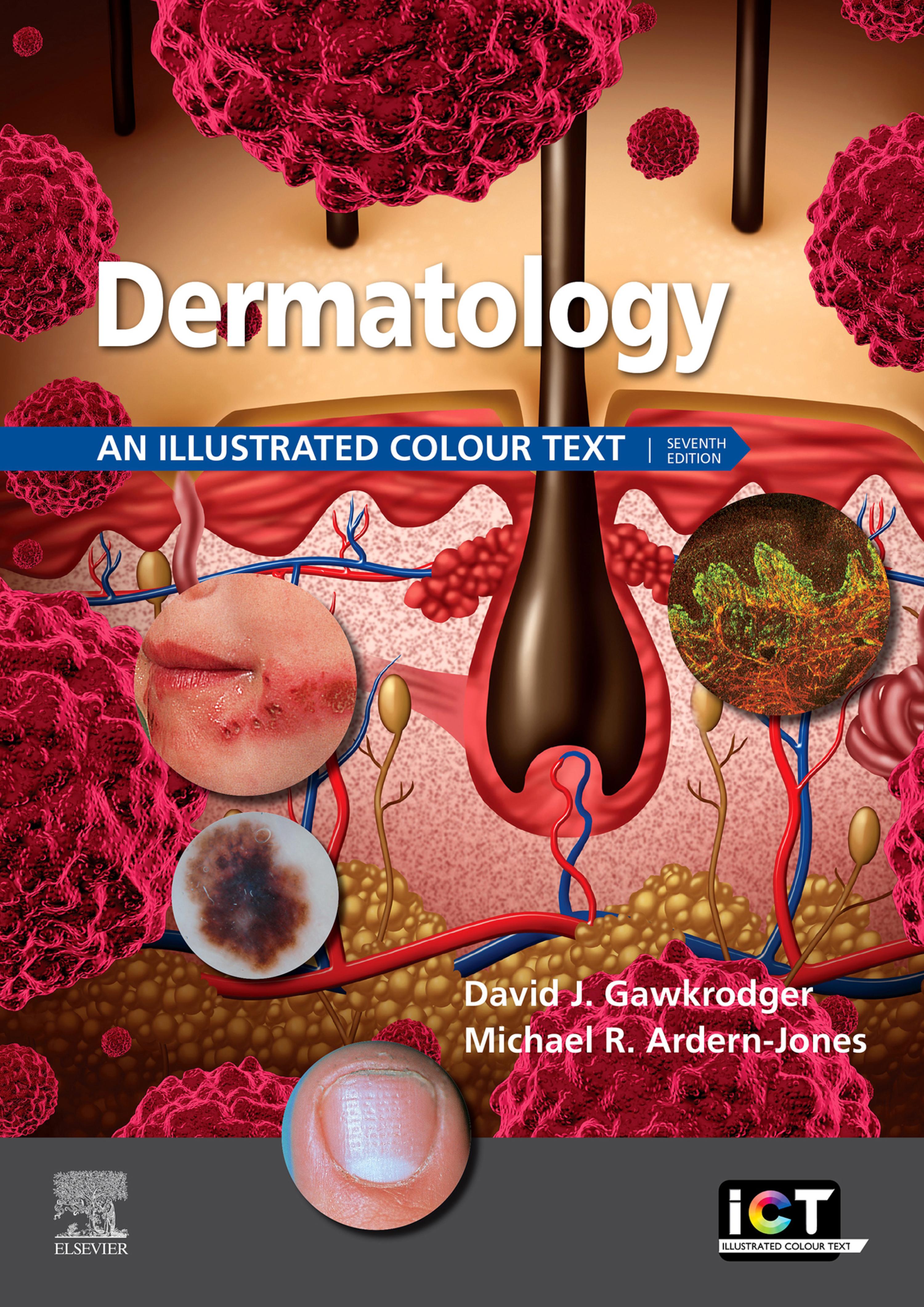 Cover image for Dermatology E-Book