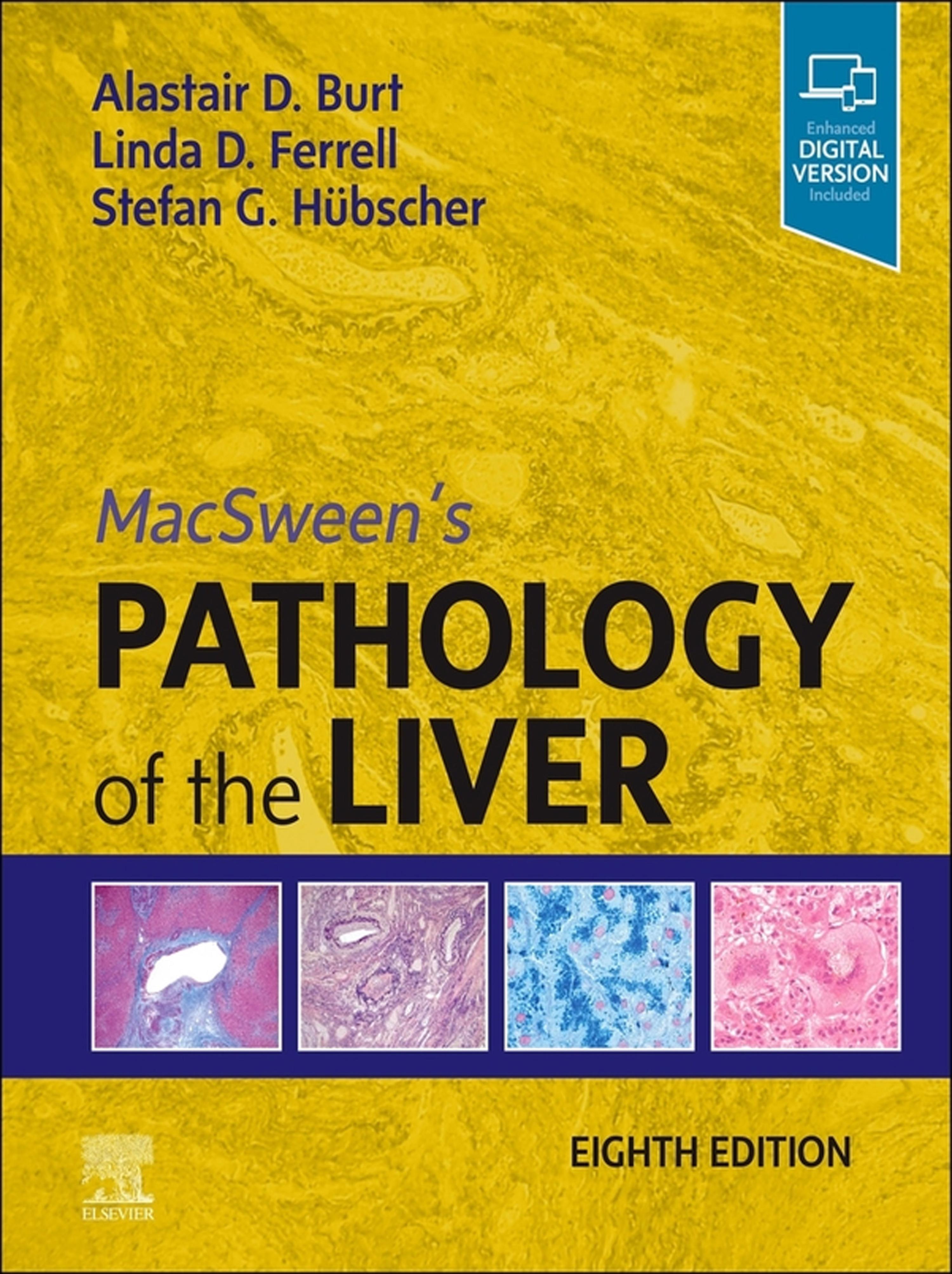 Cover image for MacSween's Pathology of the Liver, E-Book