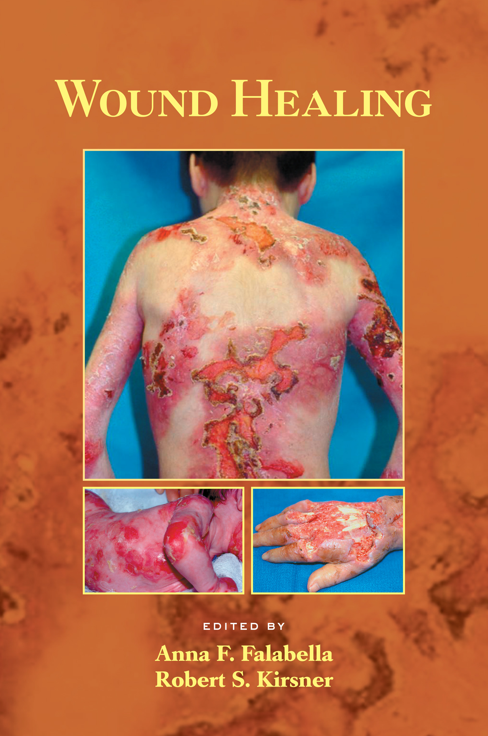 Flaps and Reconstructive Surgery E-Book by: Fu-Chan Wei 