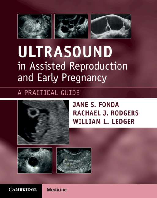 Cover image for Ultrasound in Assisted Reproduction and Early Pregnancy