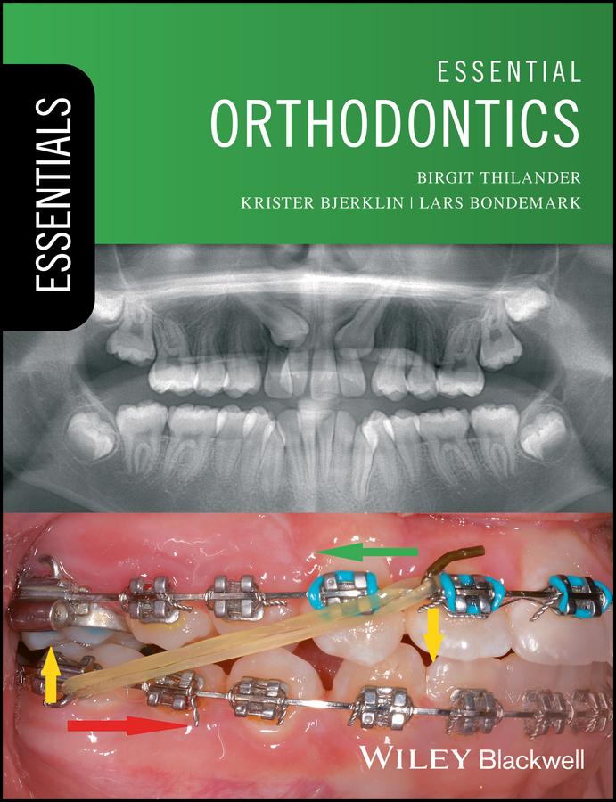 Essential Orthodontics by: Birgit Thilander - 9781119165699 | RedShelf