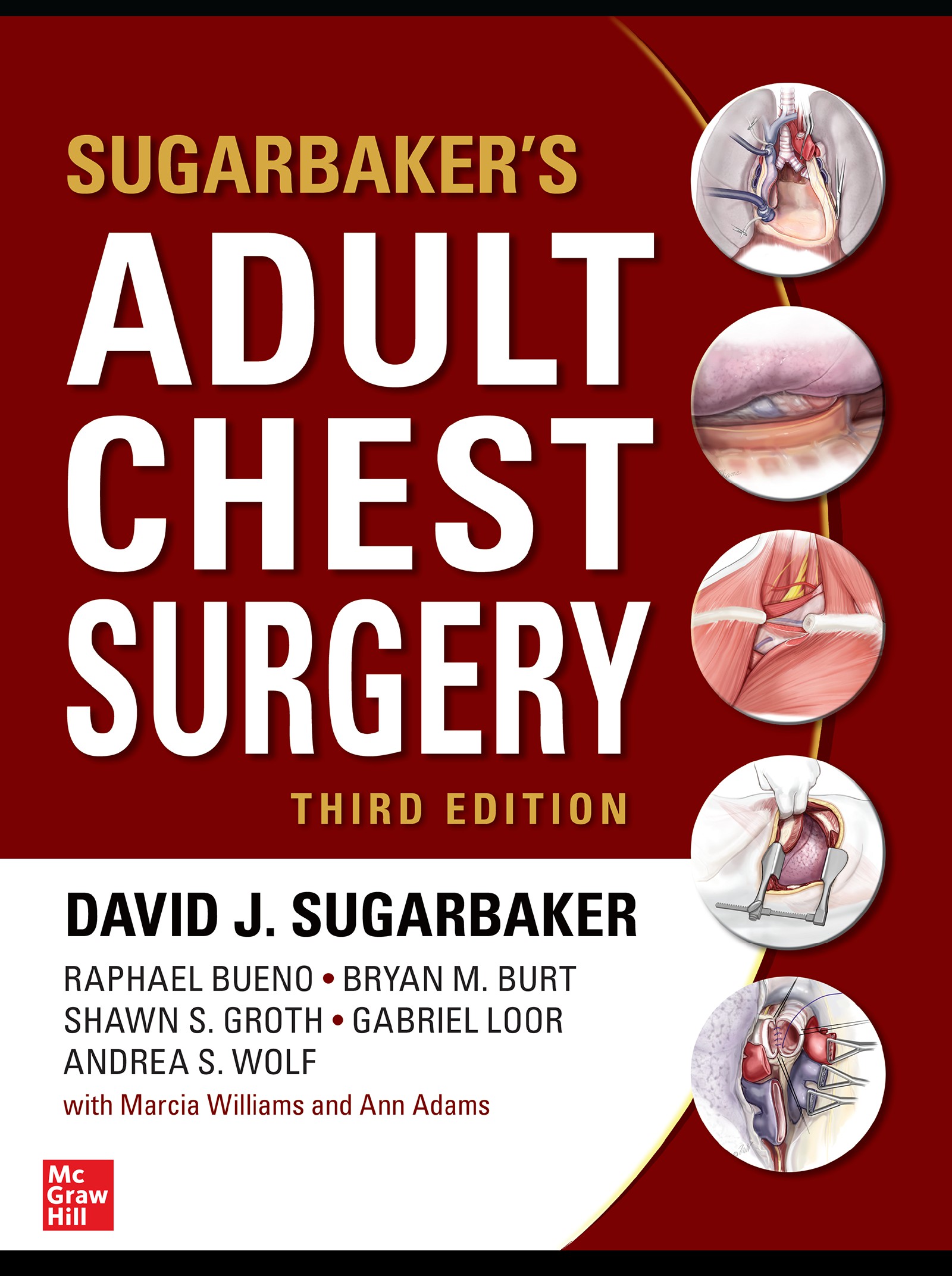 Sugarbaker's Adult Chest Surgery, Third by: David J. Sugarbaker