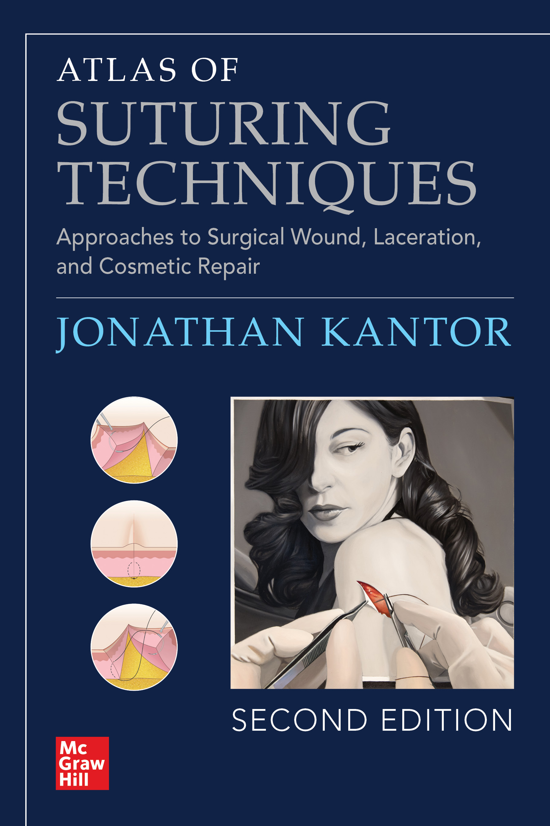 健康・医学 Atlas of Breast Surgical Techniques Atlas of Suturing Techniques: Approaches by: Jonathan