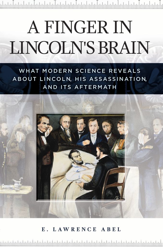 Cover image for A Finger in Lincoln's Brain
