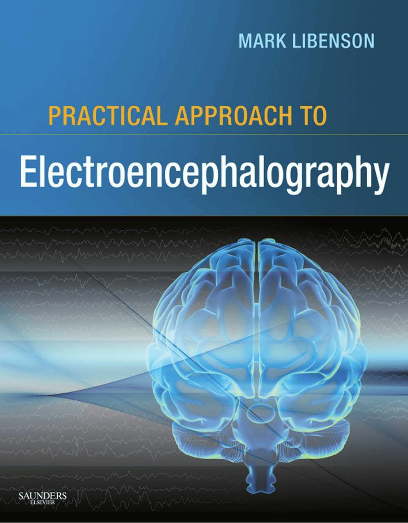 Practical Approach to Electroencephalography [ハードカバー] Libenson MD，Mark H. Practical Approach to by: Mark H. Libenson