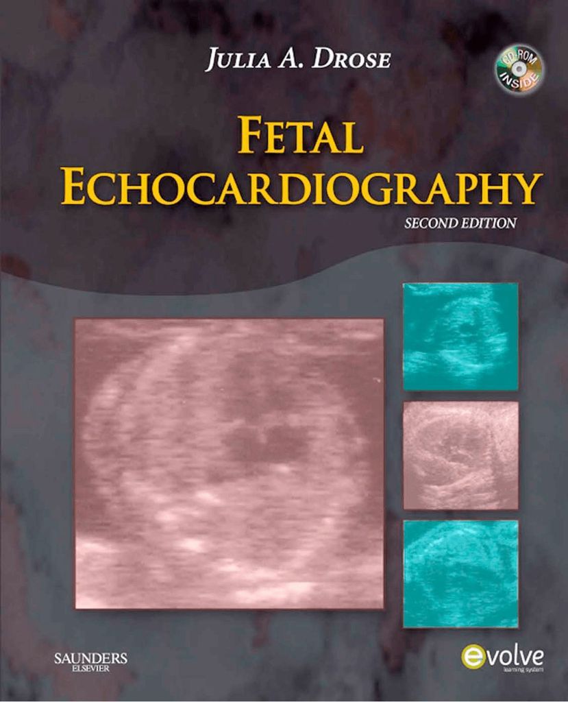 Fetal Echocardiography - E-Book by: Julia A. Drose - 9781455751853