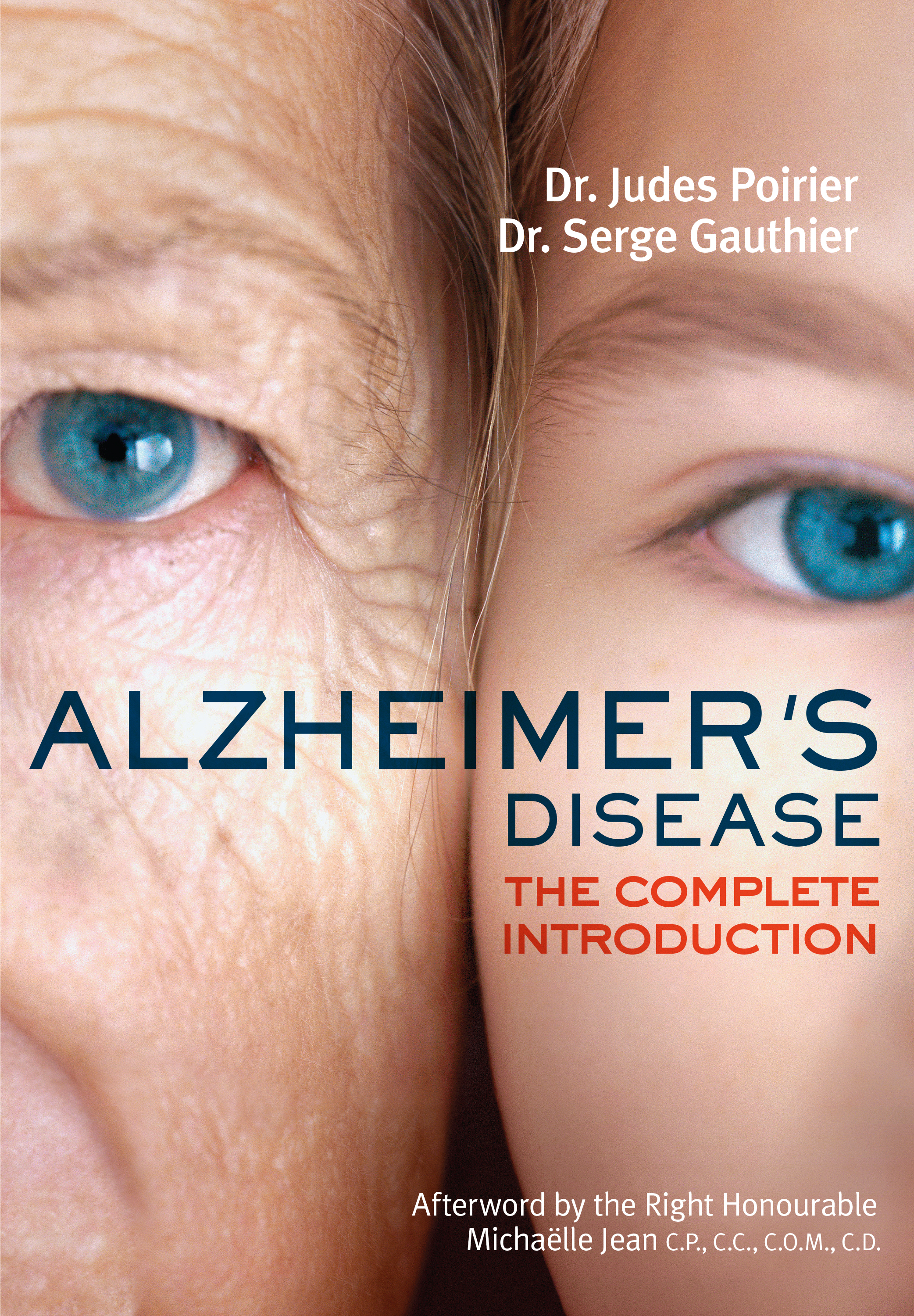 Alzheimer's Disease