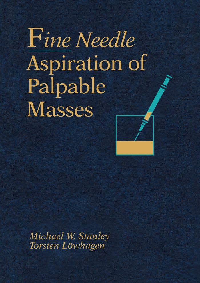 Cover image for Fine Needle Aspiration of Palpable Masses