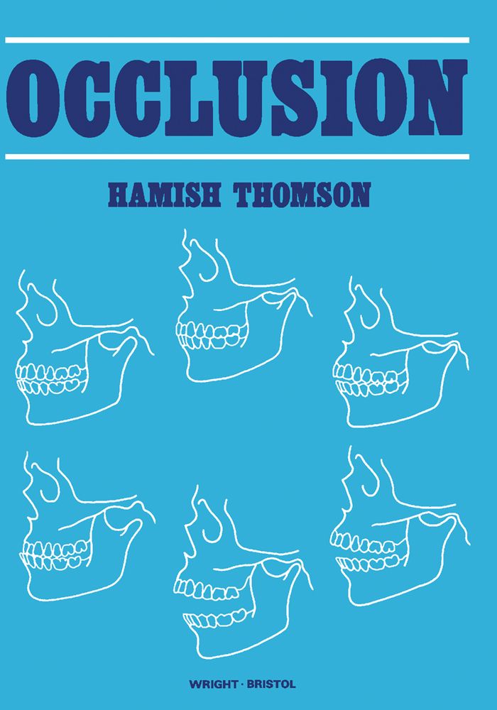 Cover image for Occlusion