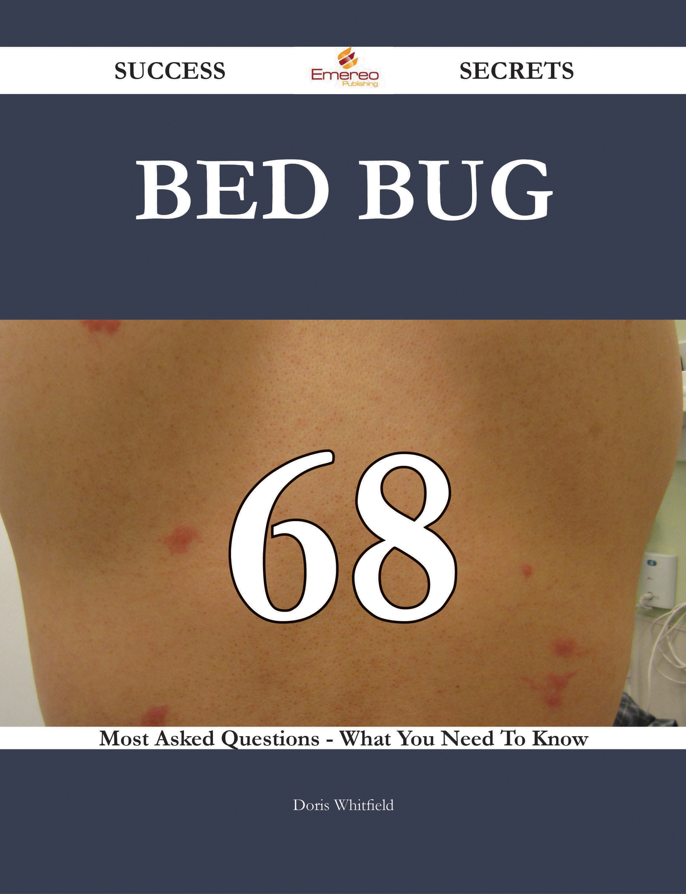 Bed bug 68 Success Secrets - 68 Most Asked Questions On Bed bug - What You Need To Know