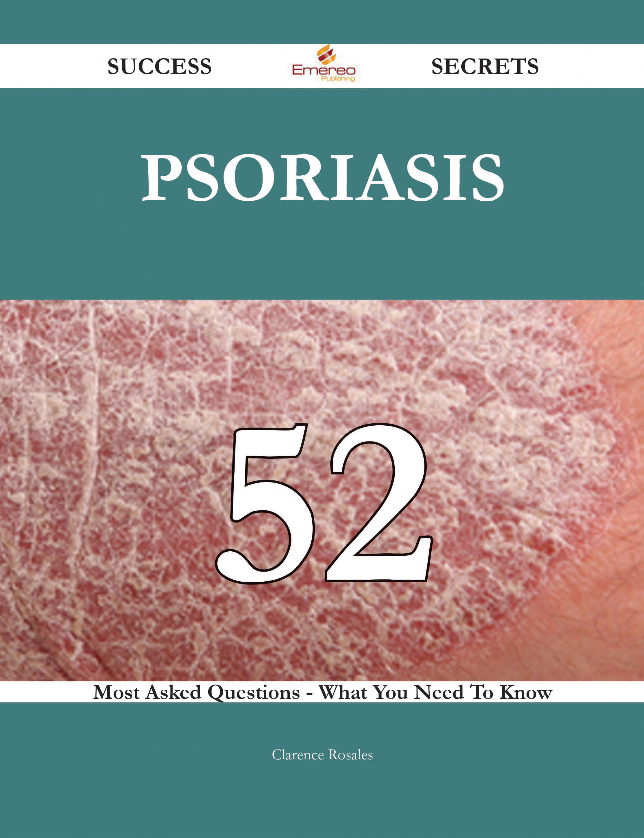 Psoriasis 52 Success Secrets - 52 Most Asked Questions On Psoriasis - What You Need To Know