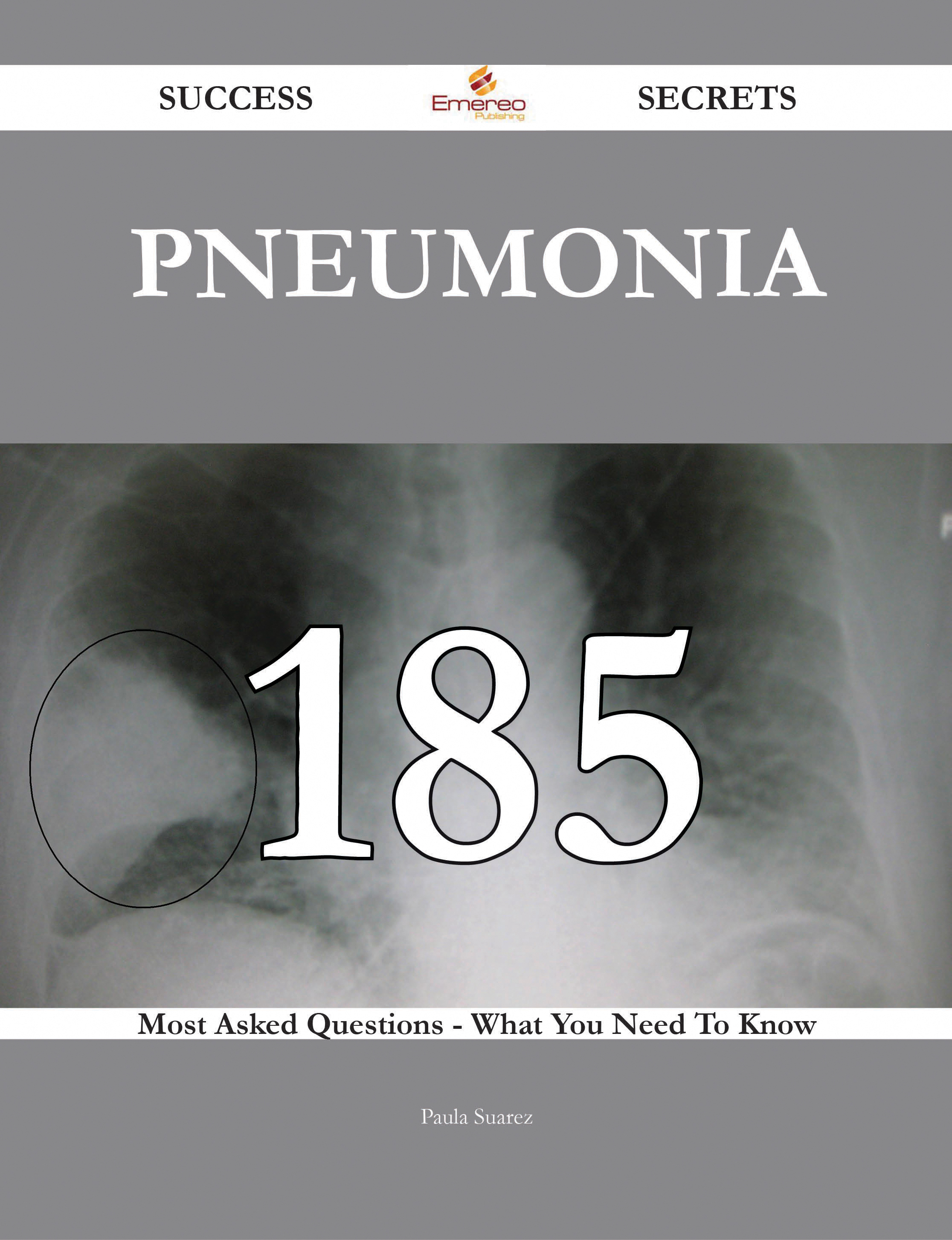 Pneumonia 185 Success Secrets - 185 Most Asked Questions On Pneumonia - What You Need To Know