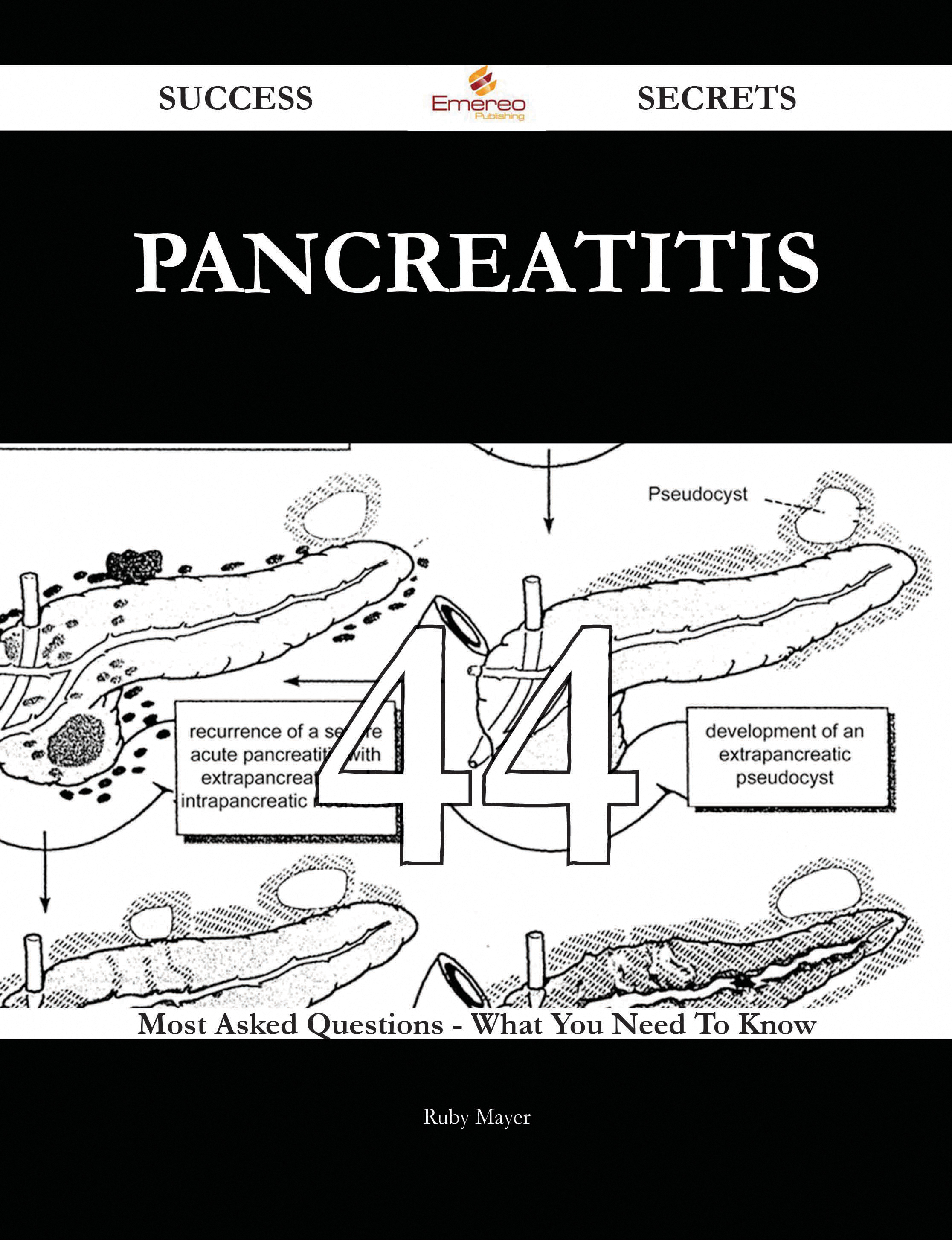 Pancreatitis 44 Success Secrets - 44 Most Asked Questions On Pancreatitis - What You Need To Know