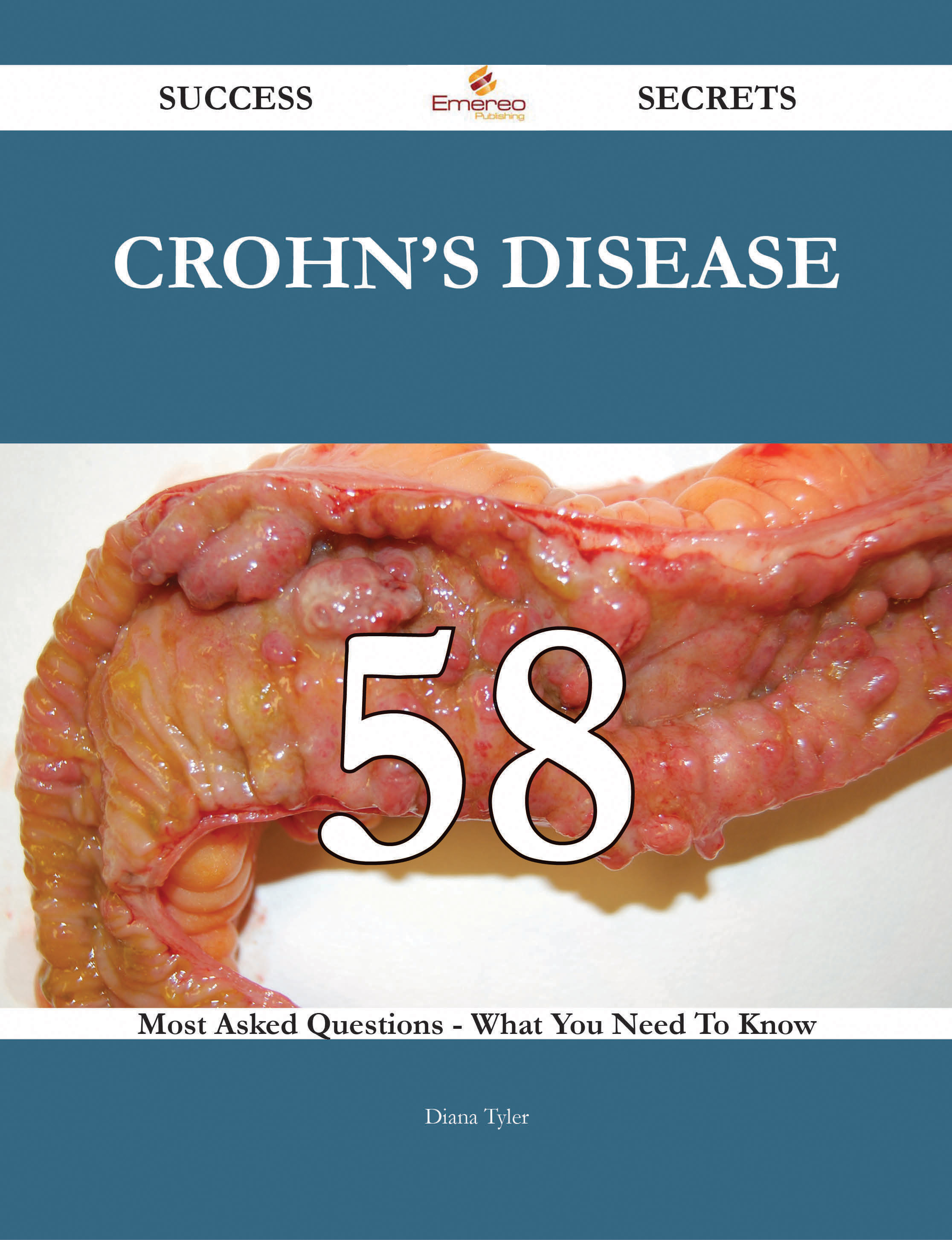 Crohn's disease 58 Success Secrets - 58 Most Asked Questions On Crohn's disease - What You Need To Know