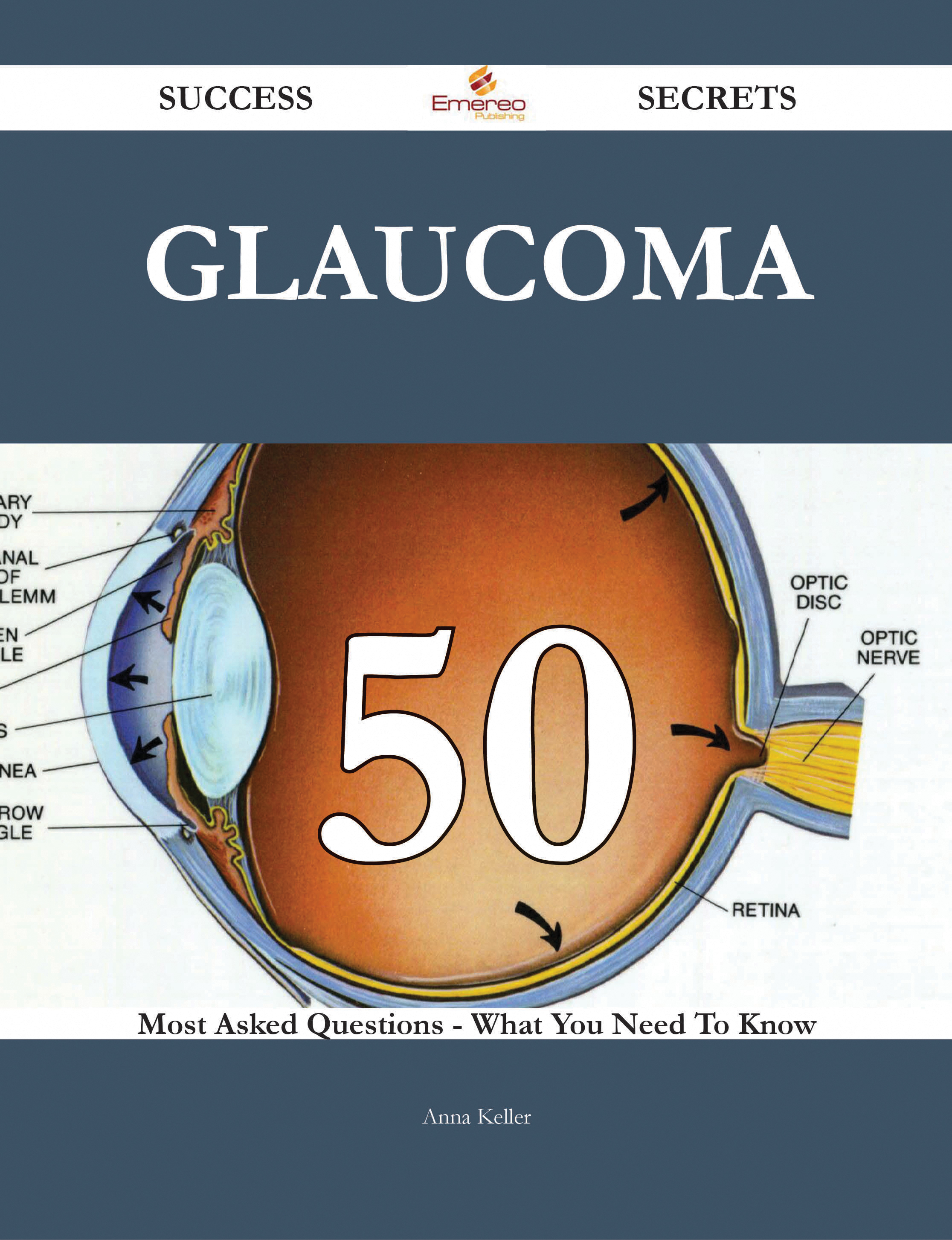 Glaucoma 50 Success Secrets - 50 Most Asked Questions On Glaucoma - What You Need To Know