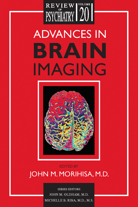 Advances in Brain Imaging