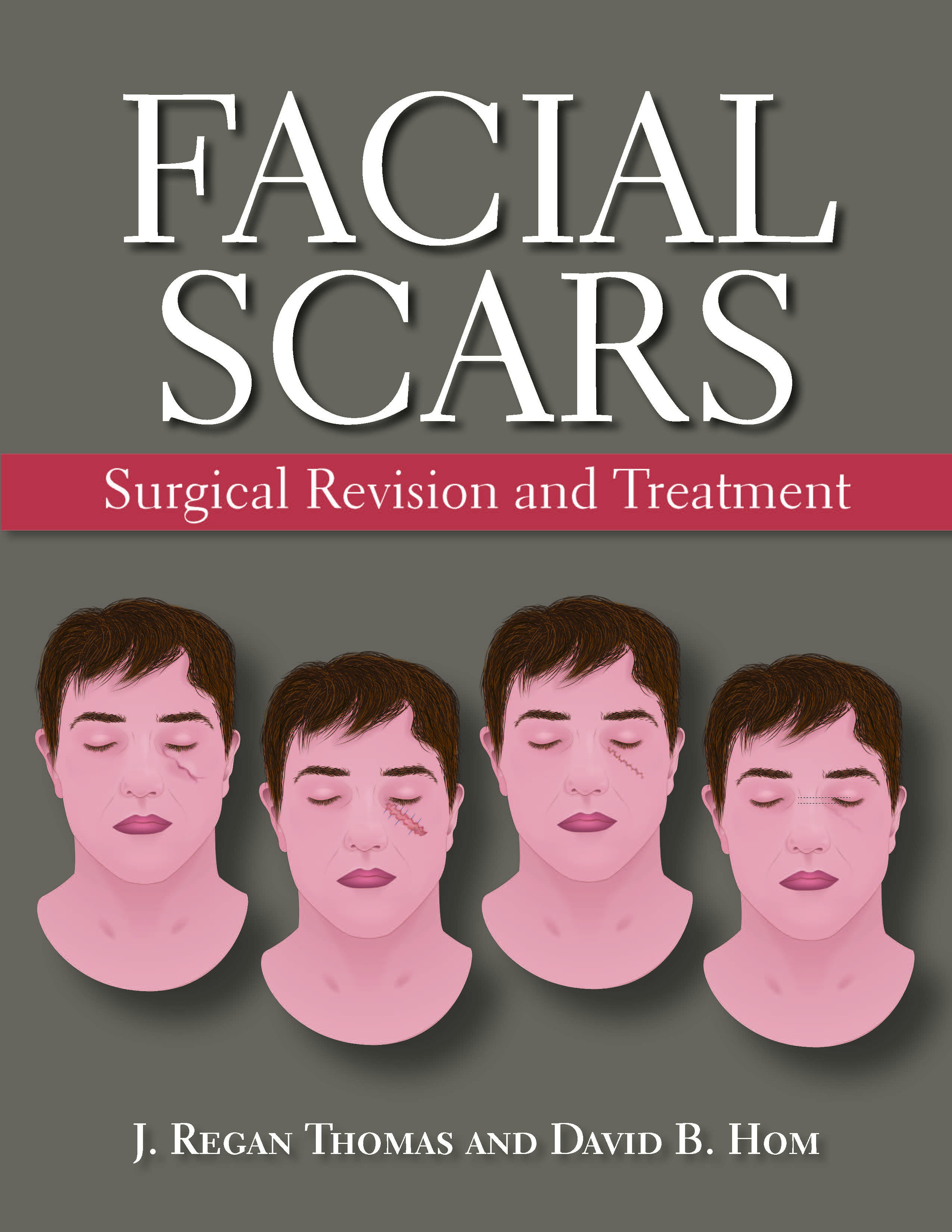 Cover image for Facial Scars