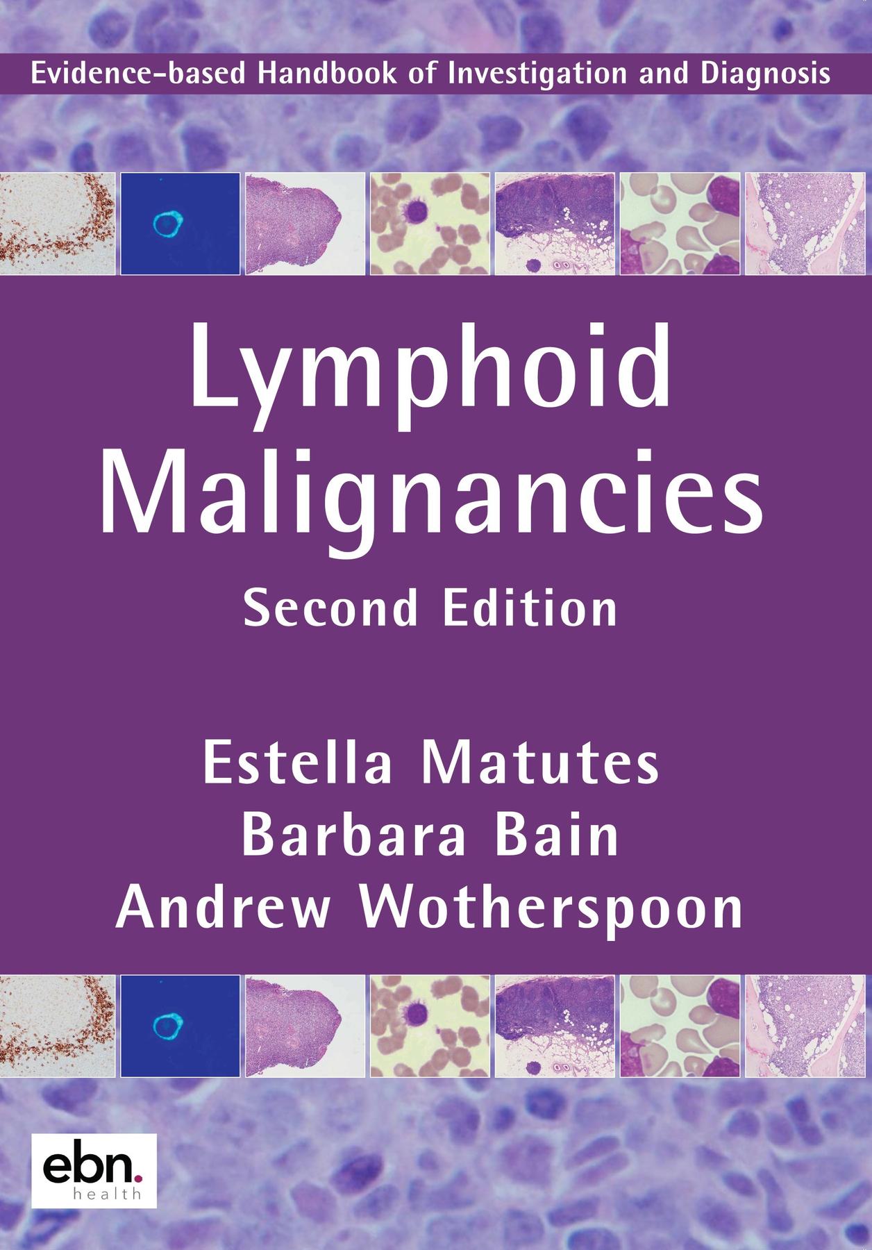 Cover image for Lymphoid Malignancies