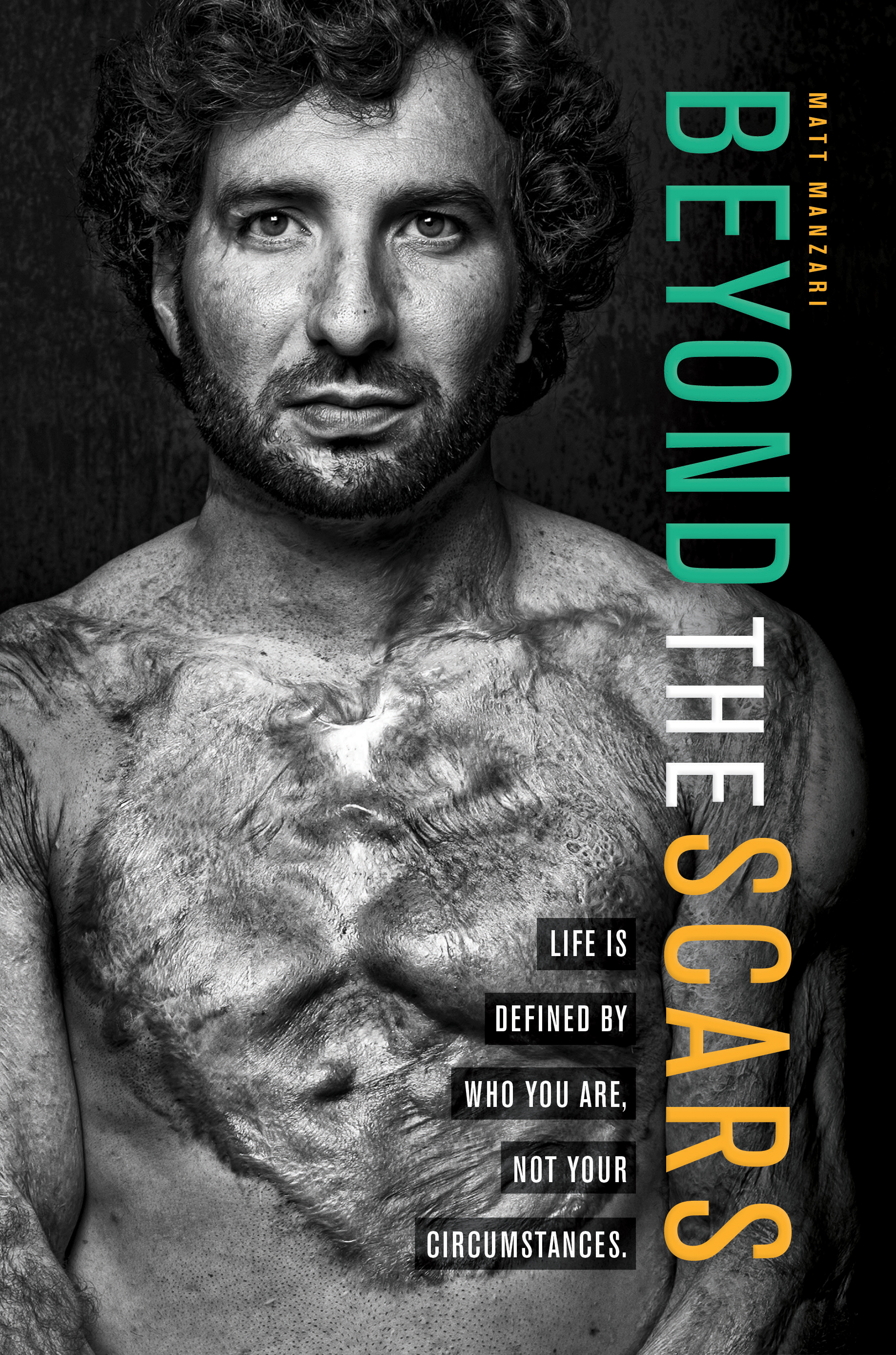 Cover image for Beyond the Scars