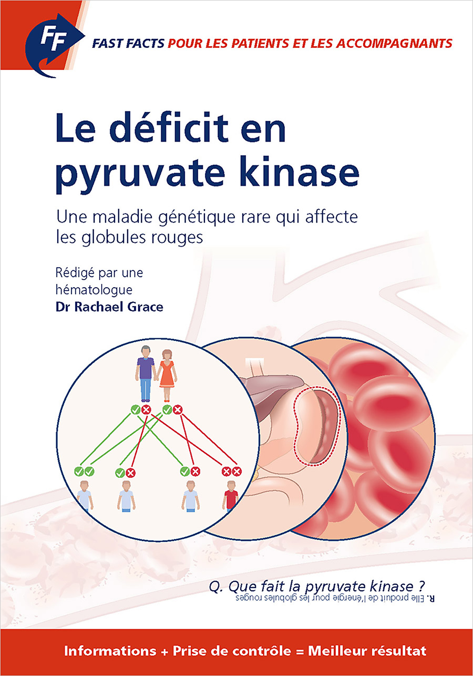 Cover image for Fast Facts: Le deficit en pyruvate kinase pour les patients et les accompagnants