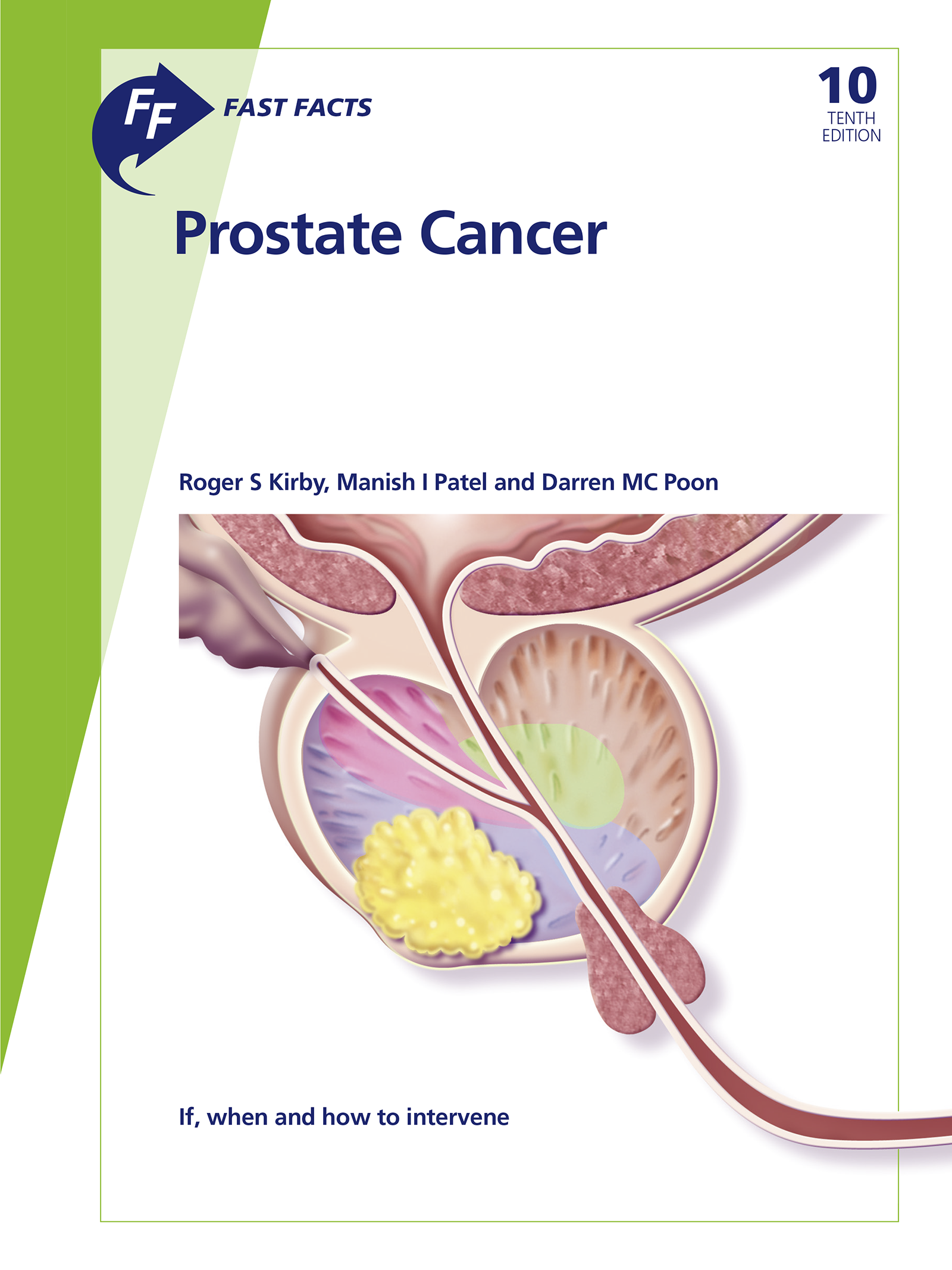 Cover image for Fast Facts: Prostate Cancer