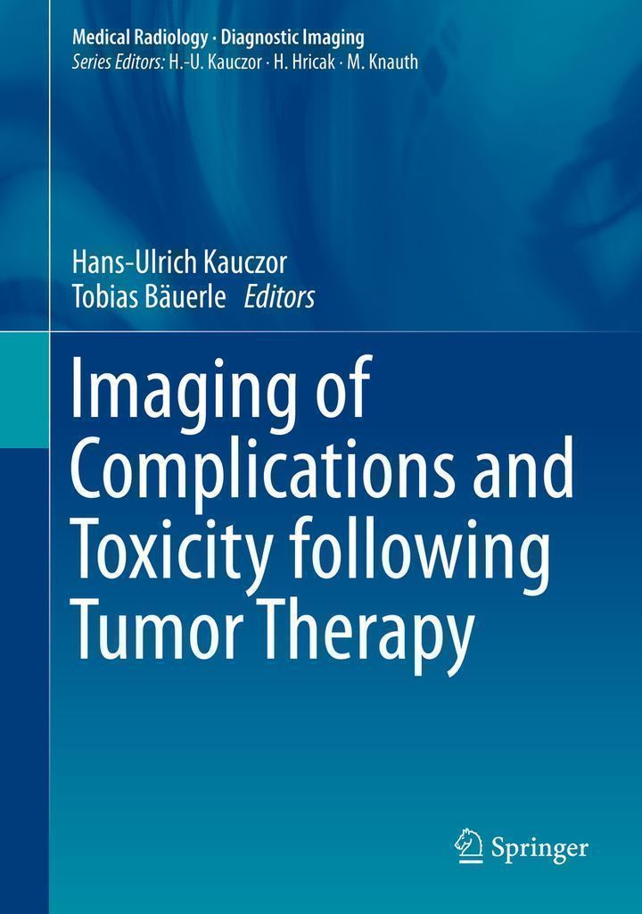 Cover image for Imaging of Complications and Toxicity following Tumor Therapy