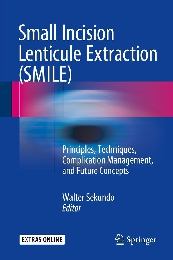 Cover image for Small Incision Lenticule Extraction (SMILE)