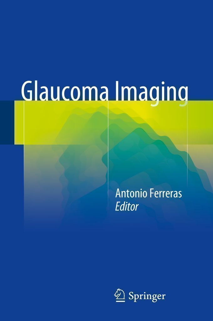 Cover image for Glaucoma Imaging